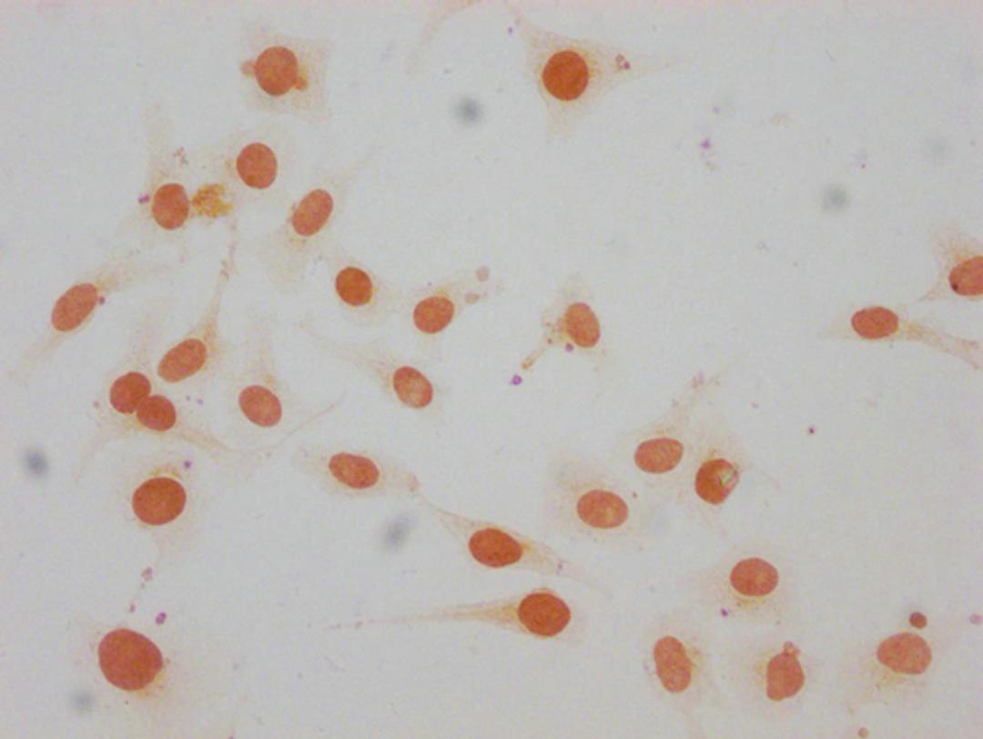Immunocytochemistry analysis of CSB-PA010380OA147me1HU diluted at 1:15 and staining in Hela cells performed on a Leica BondTM system. The cells were fixed in 4% formaldehyde, permeabilized using 0.2% Triton X-100 and blocked with 10% normal goat serum 30min at RT. Then primary antibody (1% BSA) was incubated at 4°C overnight. The primary is detected by a biotinylated secondary antibody and visualized using an HRP conjugated SP system.