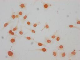 Immunocytochemistry analysis of CSB-PA010380OA147me1HU diluted at 1:15 and staining in Hela cells performed on a Leica BondTM system. The cells were fixed in 4% formaldehyde, permeabilized using 0.2% Triton X-100 and blocked with 10% normal goat serum 30min at RT. Then primary antibody (1% BSA) was incubated at 4°C overnight. The primary is detected by a biotinylated secondary antibody and visualized using an HRP conjugated SP system.
