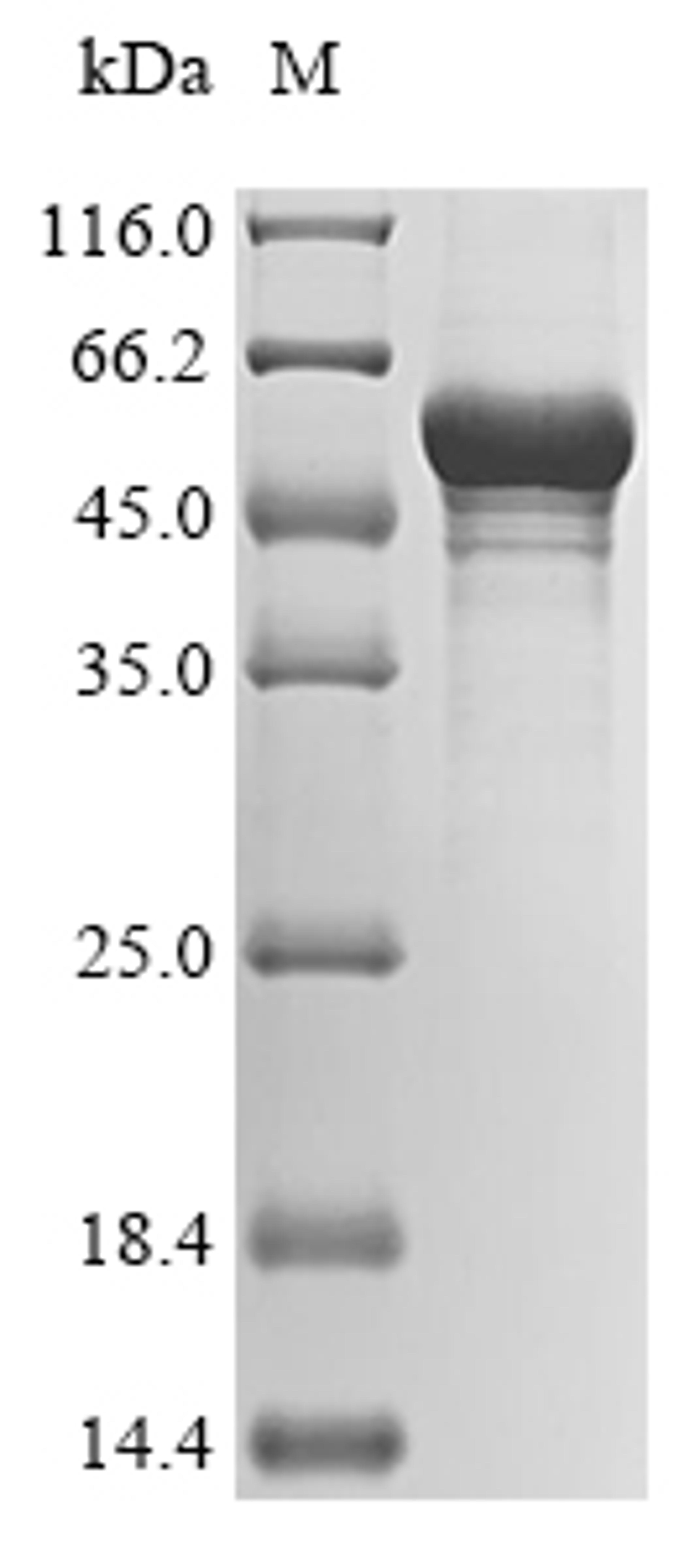 (Tris-Glycine gel) Discontinuous SDS-PAGE (reduced) with 5% enrichment gel and 15% separation gel.