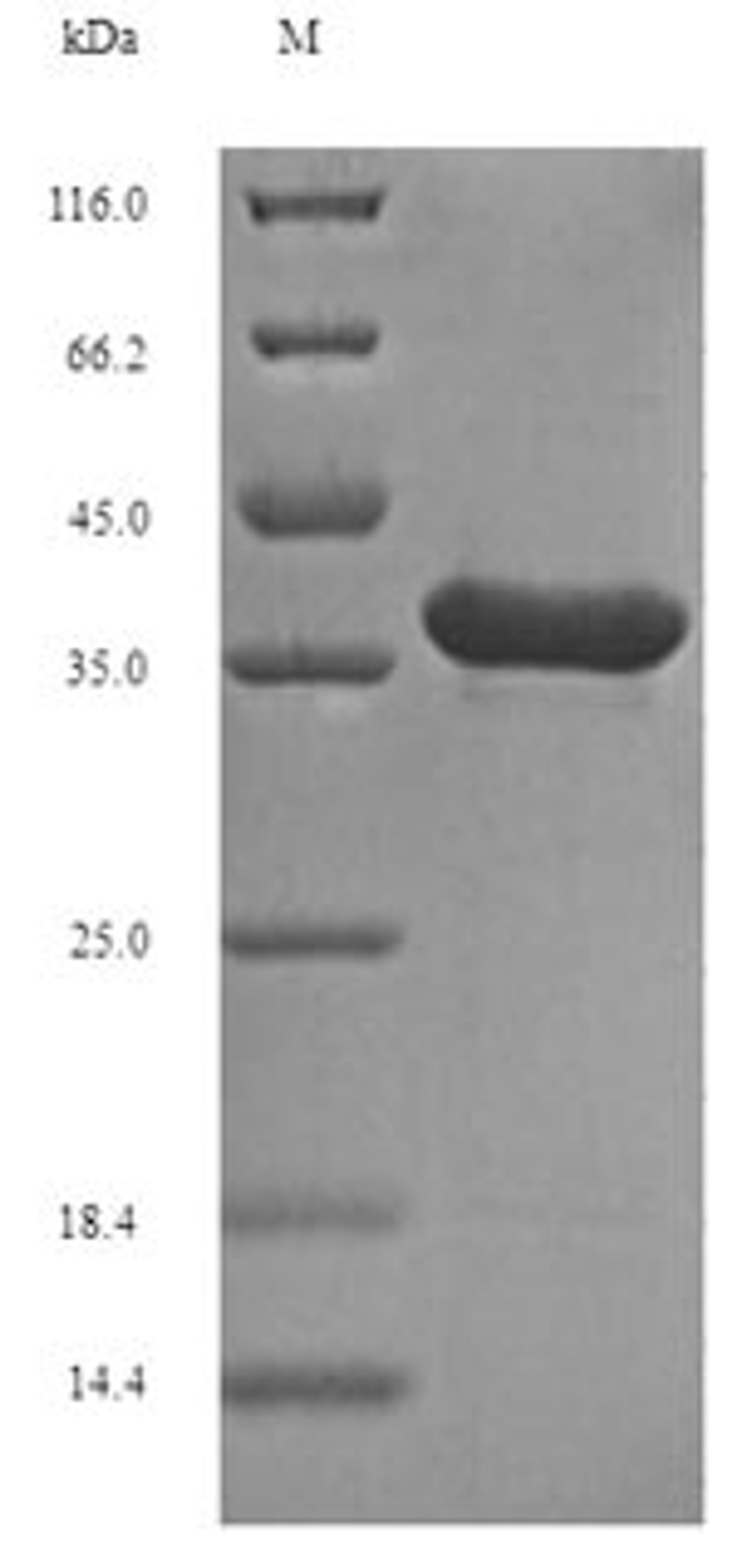 (Tris-Glycine gel) Discontinuous SDS-PAGE (reduced) with 5% enrichment gel and 15% separation gel.
