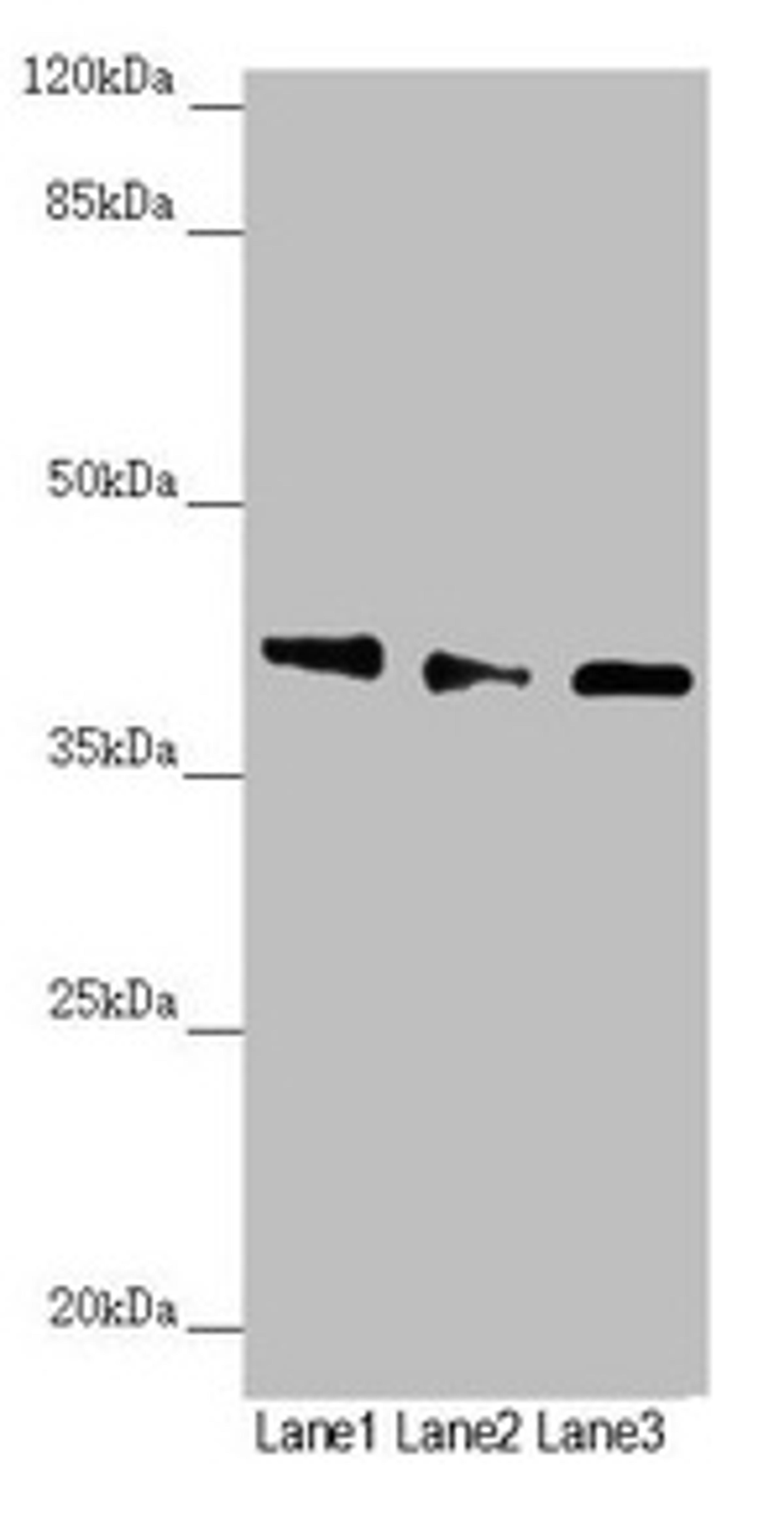 Western blot. All lanes: DYNC2LI1 antibody at 1.17µg/ml. Lane 1: 293T whole cell lysate. Lane 2: A549 whole cell lysate. Lane 3: Mouse gonadal tissue. Secondary. Goat polyclonal to rabbit IgG at 1/10000 dilution. Predicted band size: 40, 38, 23, 16 kDa. Observed band size: 40 kDa