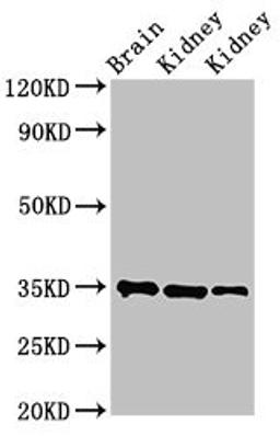 Western Blot. Positive WB detected in: Rat brain tissue, Rat kidney tissue, Mouse kidney tissue. All lanes: RPLP0 antibody at 3.4µg/ml. Secondary. Goat polyclonal to rabbit IgG at 1/50000 dilution. Predicted band size: 35, 28 kDa. Observed band size: 35 kDa