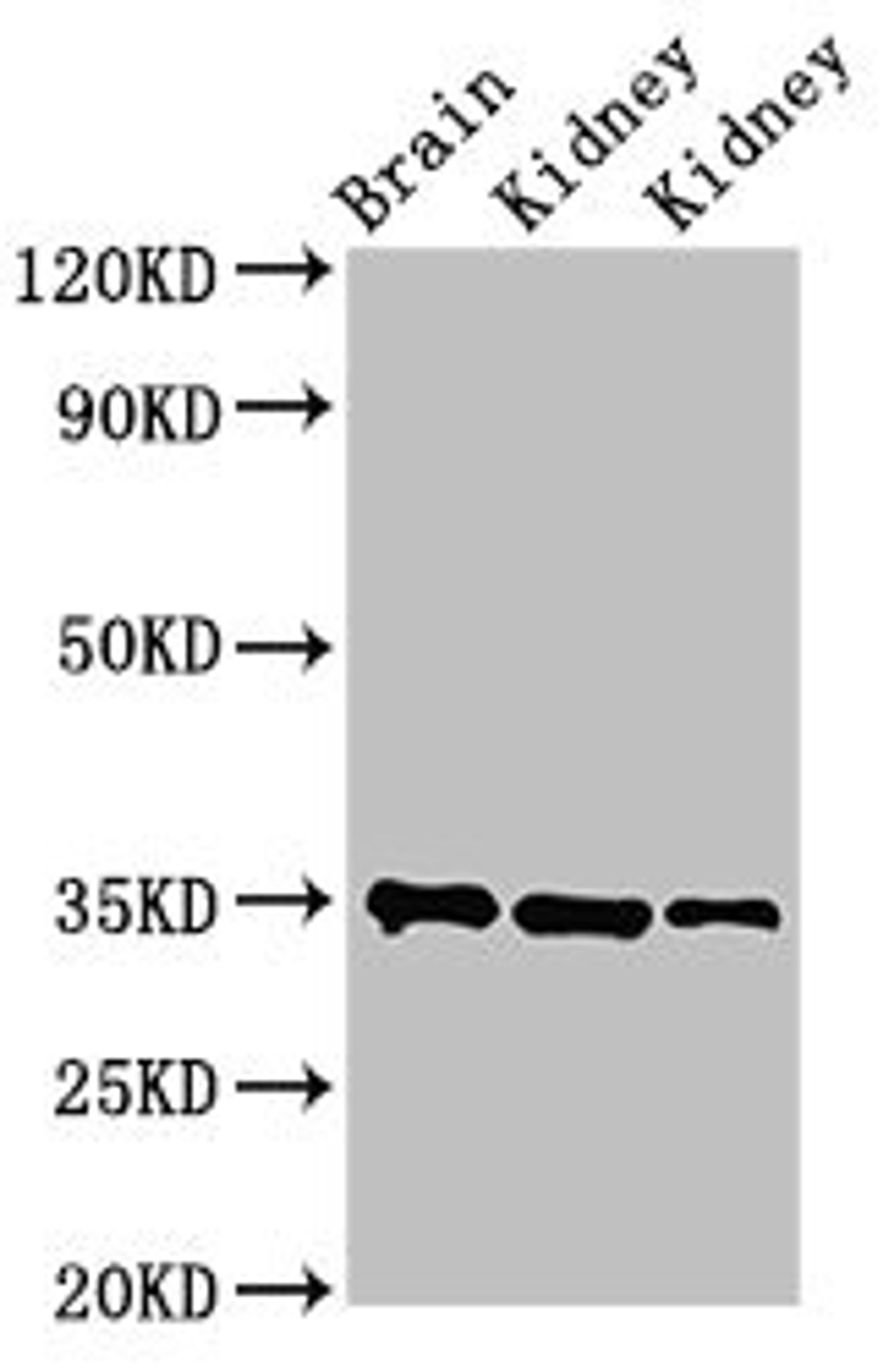 Western Blot. Positive WB detected in: Rat brain tissue, Rat kidney tissue, Mouse kidney tissue. All lanes: RPLP0 antibody at 3.4µg/ml. Secondary. Goat polyclonal to rabbit IgG at 1/50000 dilution. Predicted band size: 35, 28 kDa. Observed band size: 35 kDa
