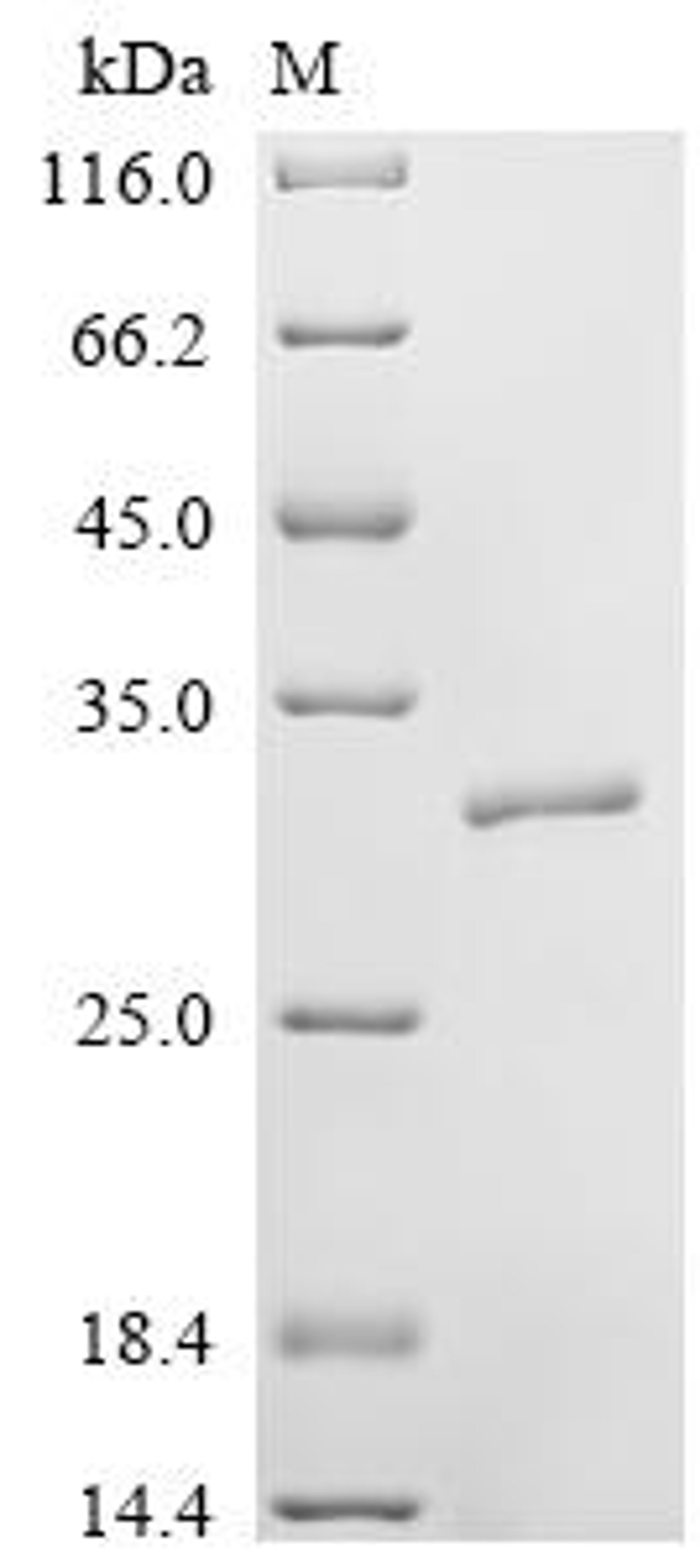 (Tris-Glycine gel) Discontinuous SDS-PAGE (reduced) with 5% enrichment gel and 15% separation gel.