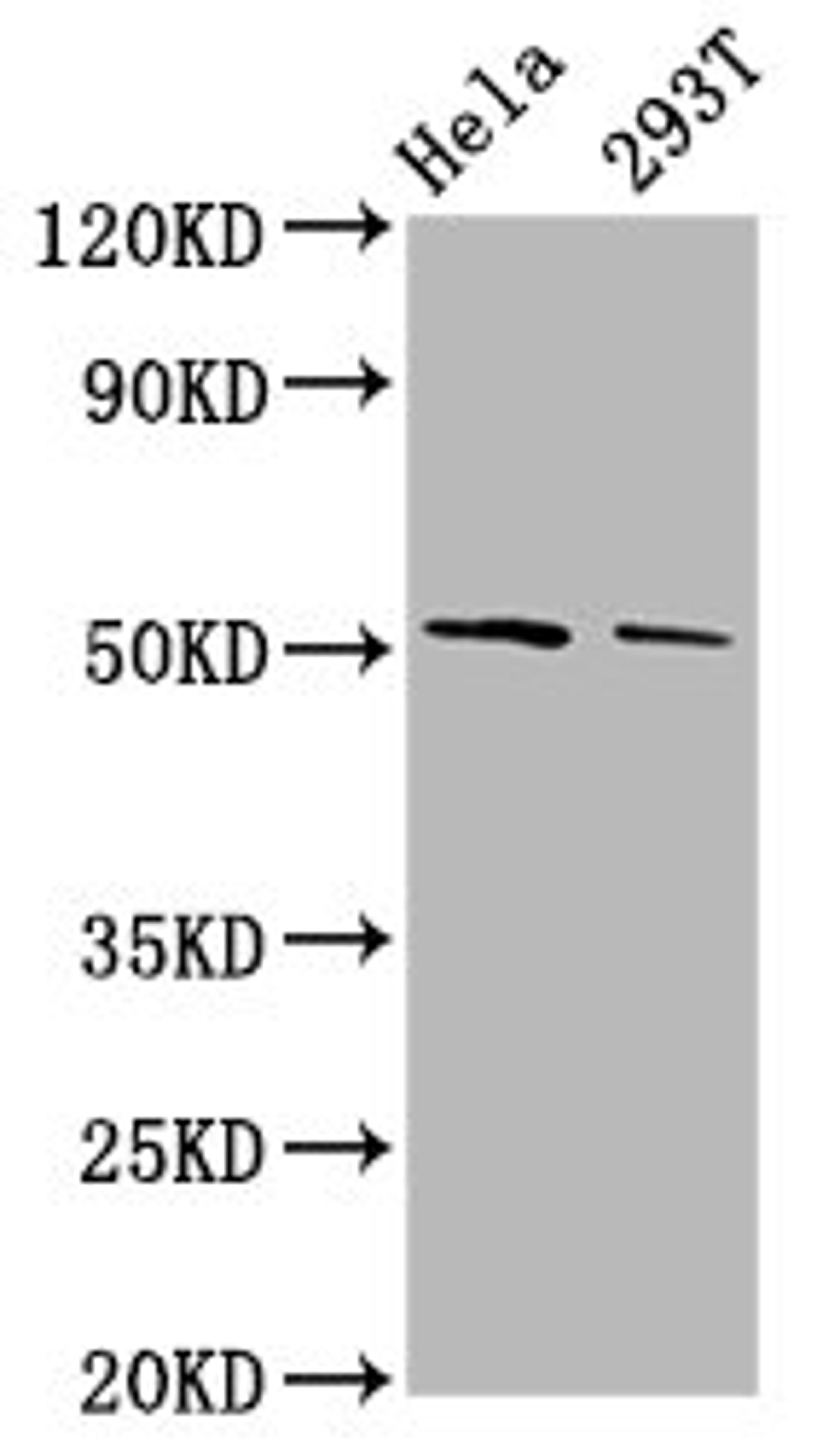 Western Blot. Positive WB detected in: Hela whole cell lysate, 293T whole cell lysate. All lanes: PLAGL2 antibody at 3.8µg/ml. Secondary. Goat polyclonal to rabbit IgG at 1/50000 dilution. Predicted band size: 55 kDa. Observed band size: 55 kDa