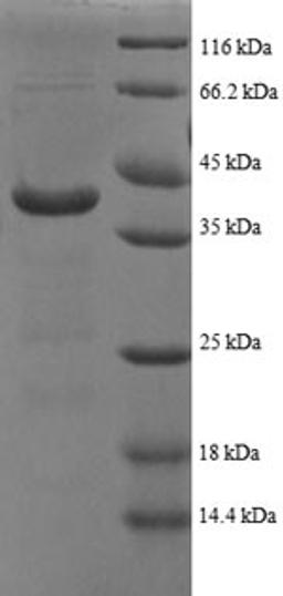 (Tris-Glycine gel) Discontinuous SDS-PAGE (reduced) with 5% enrichment gel and 15% separation gel.