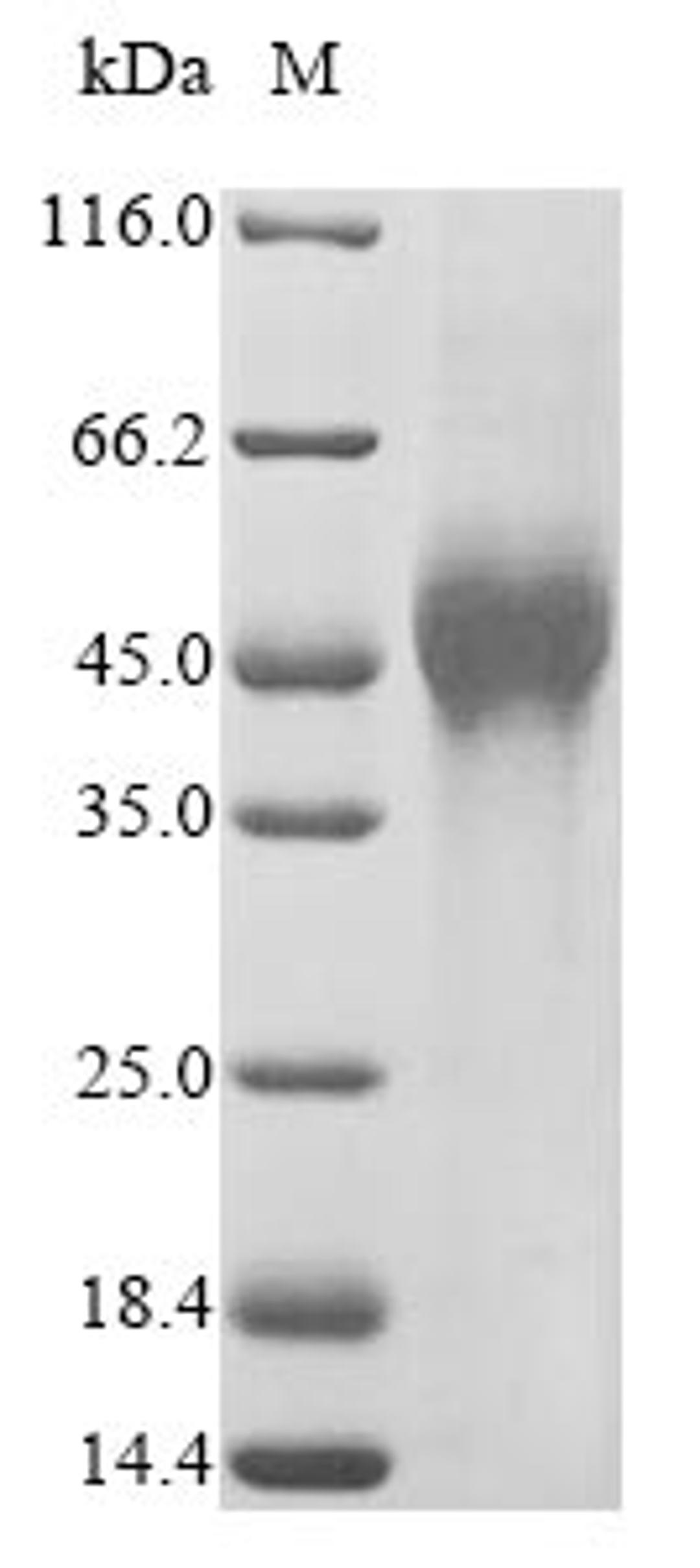 (Tris-Glycine gel) Discontinuous SDS-PAGE (reduced) with 5% enrichment gel and 15% separation gel.