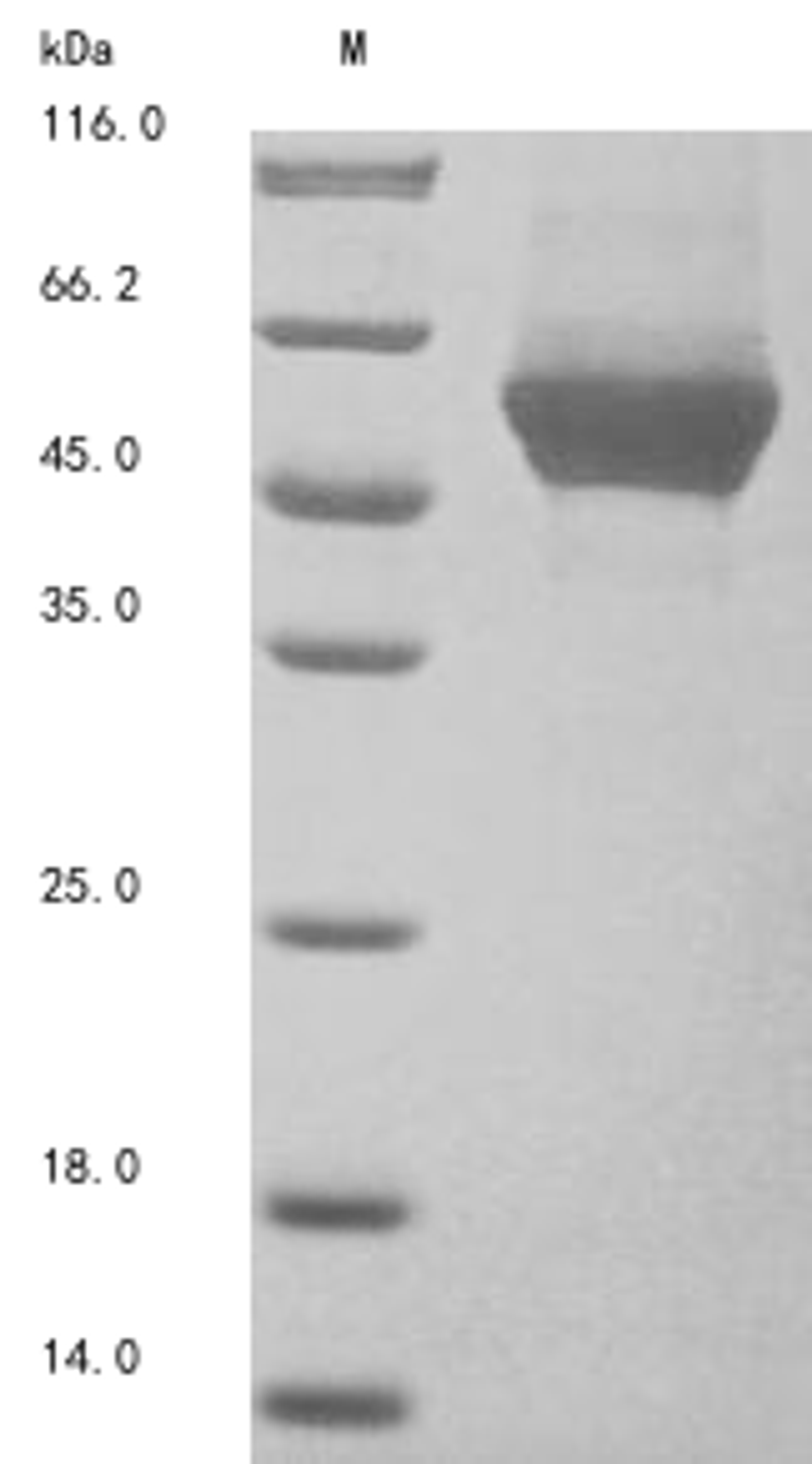 (Tris-Glycine gel) Discontinuous SDS-PAGE (reduced) with 5% enrichment gel and 15% separation gel.