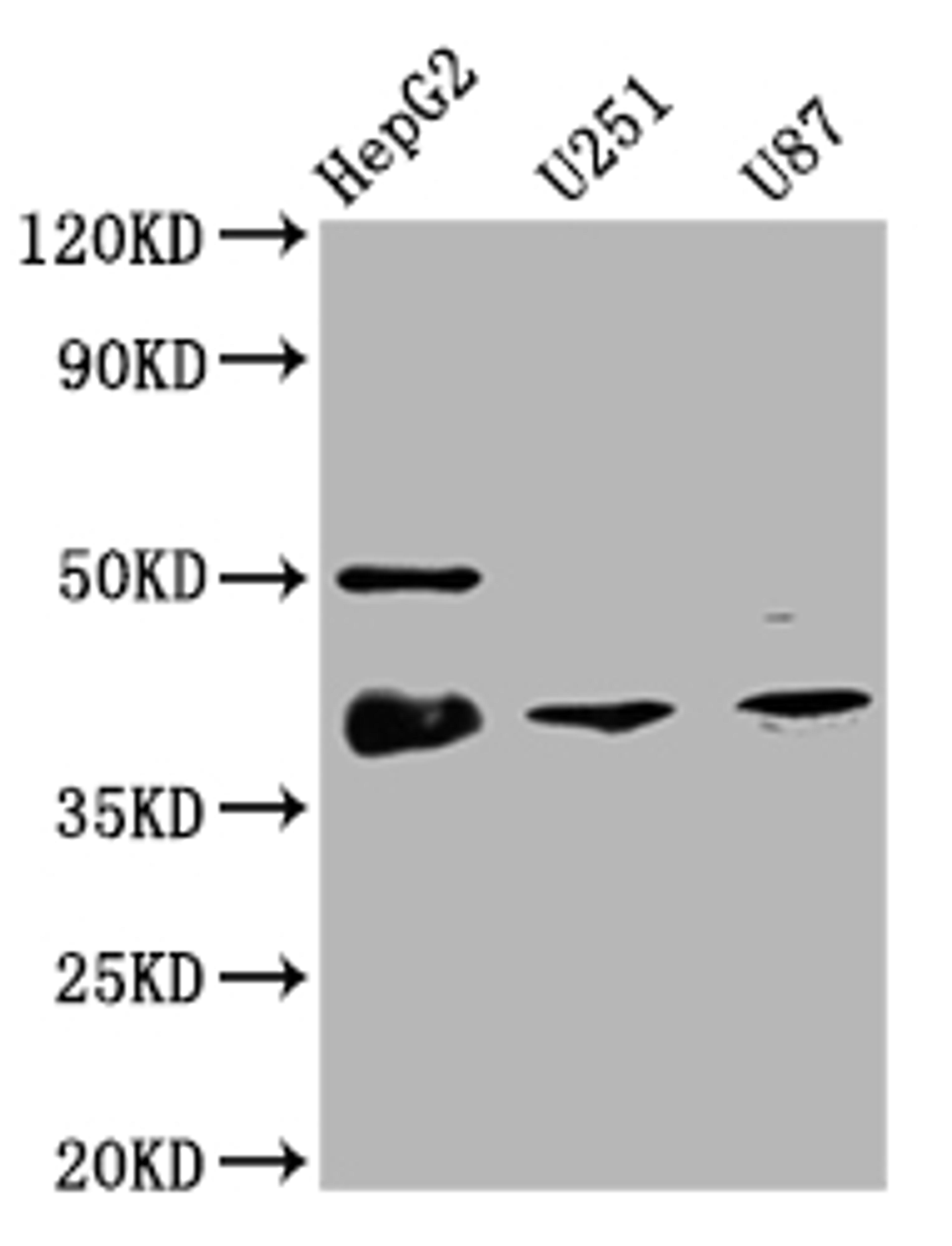 Western Blot. Positive WB detected in: HepG2 whole cell lysate, U251 whole cell lysate, U87 whole cell lysate. All lanes: TTF1 antibody at 1:2000. Secondary. Goat polyclonal to rabbit IgG at 1/50000 dilution. Predicted band size: 39 kDa. Observed band size: 39 kDa.