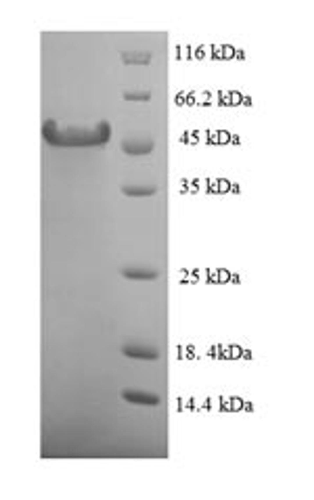 (Tris-Glycine gel) Discontinuous SDS-PAGE (reduced) with 5% enrichment gel and 15% separation gel.