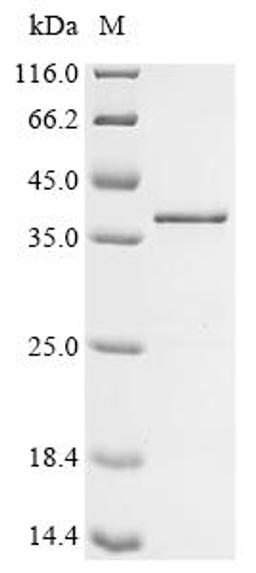 (Tris-Glycine gel) Discontinuous SDS-PAGE (reduced) with 5% enrichment gel and 15% separation gel.