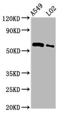 Western Blot. Positive WB detected in: A549 whole cell lysate, LO2 whole cell lysate. All lanes: PARP3 antibody at 3.5µg/ml. Secondary. Goat polyclonal to rabbit IgG at 1/50000 dilution. Predicted band size: 61 kDa. Observed band size: 61 kDa