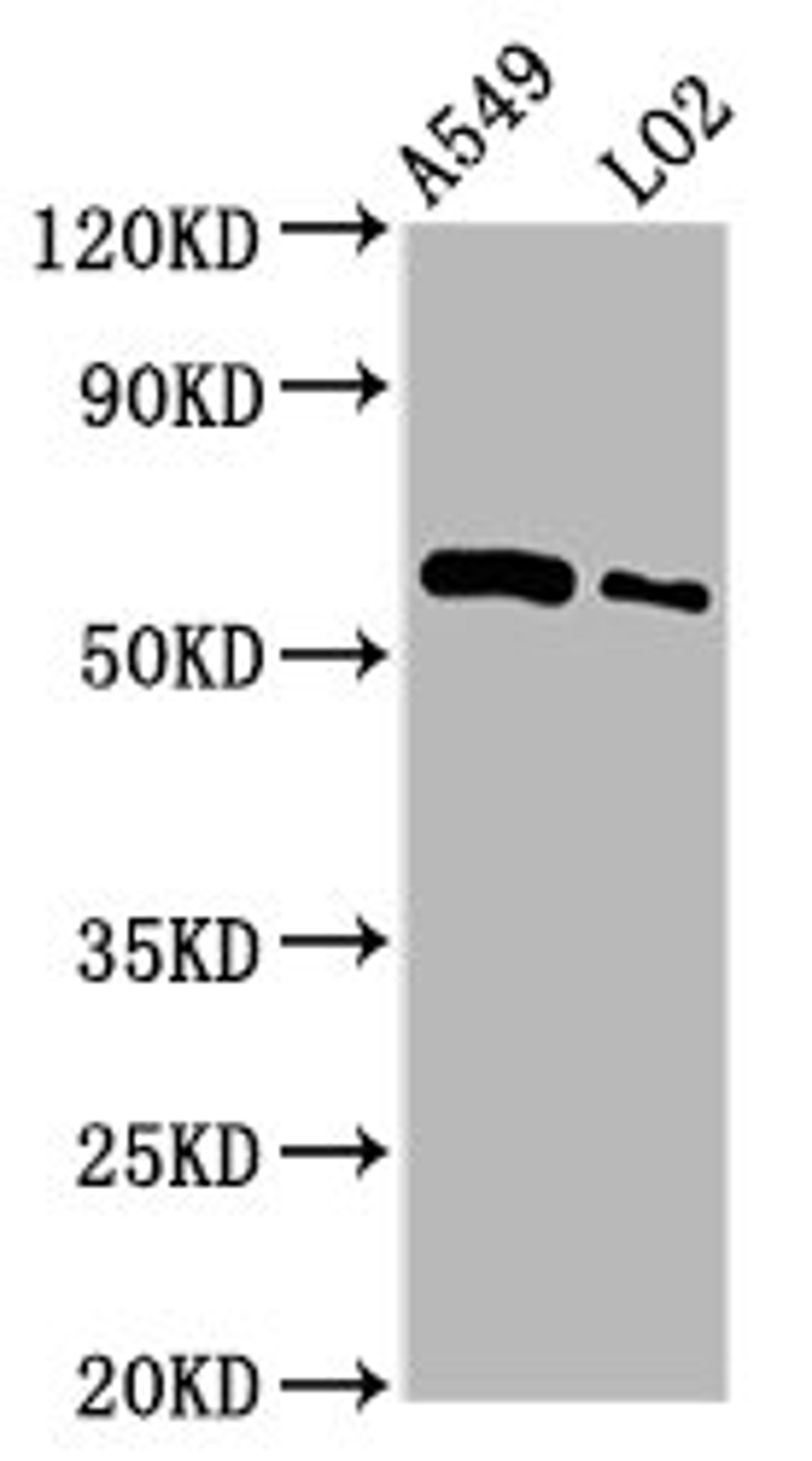 Western Blot. Positive WB detected in: A549 whole cell lysate, LO2 whole cell lysate. All lanes: PARP3 antibody at 3.5µg/ml. Secondary. Goat polyclonal to rabbit IgG at 1/50000 dilution. Predicted band size: 61 kDa. Observed band size: 61 kDa