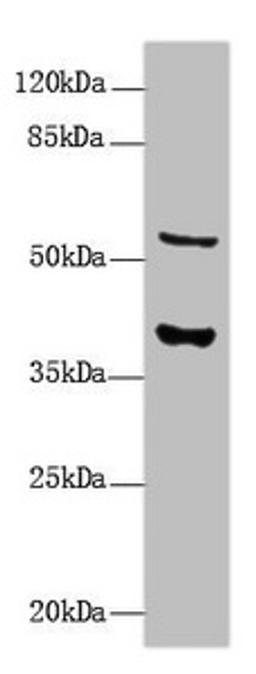Western Blot. All lanes: CALHM3 antibody at 8µg/ml + Mouse kidney tissue. Secondary. Goat polyclonal to rabbit IgG at 1/10000 dilution. Predicted band size: 40, 39 kDa. Observed band size: 40, 55 kDa