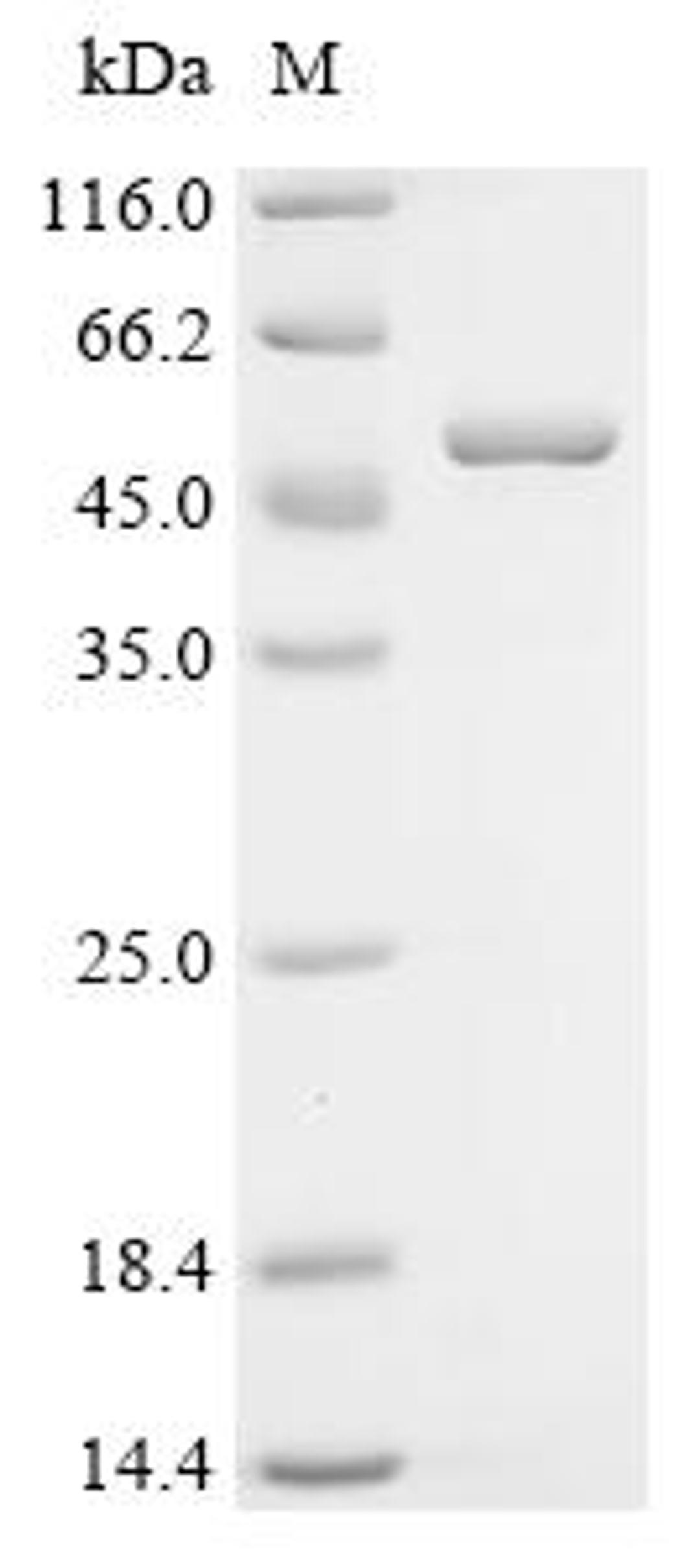 (Tris-Glycine gel) Discontinuous SDS-PAGE (reduced) with 5% enrichment gel and 15% separation gel.