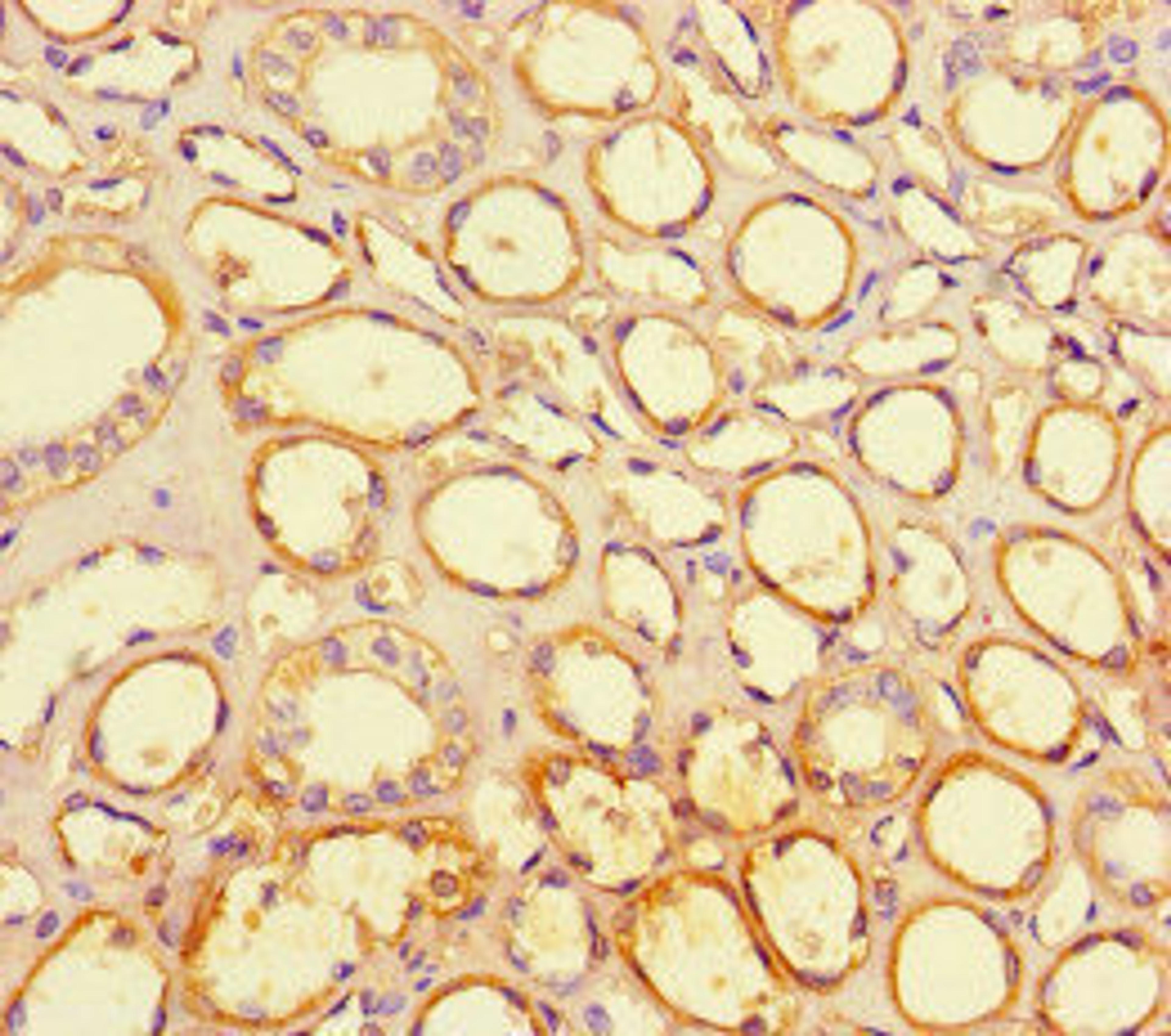 Immunohistochemistry of paraffin-embedded human kidney tissue using CSB-PA836247LA01HU at dilution of 1:100