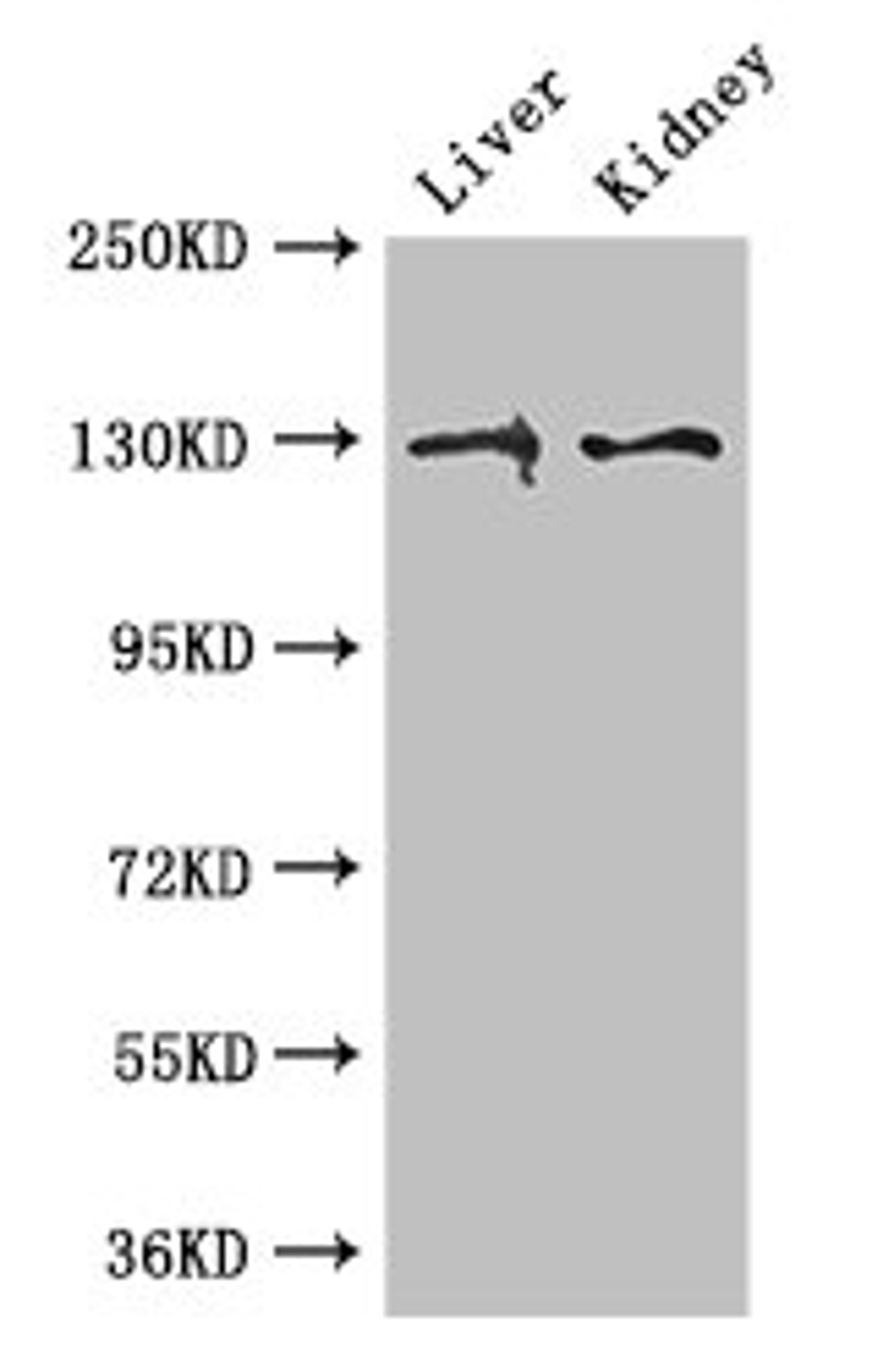 Western Blot. Positive WB detected in: Mouse liver tissue, Mouse kidney tissue. All lanes: PC antibody at 3ug/ml. Secondary. Goat polyclonal to rabbit IgG at 1/50000 dilution. Predicted band size: 130, 58 kDa. Observed band size: 130 kDa. 