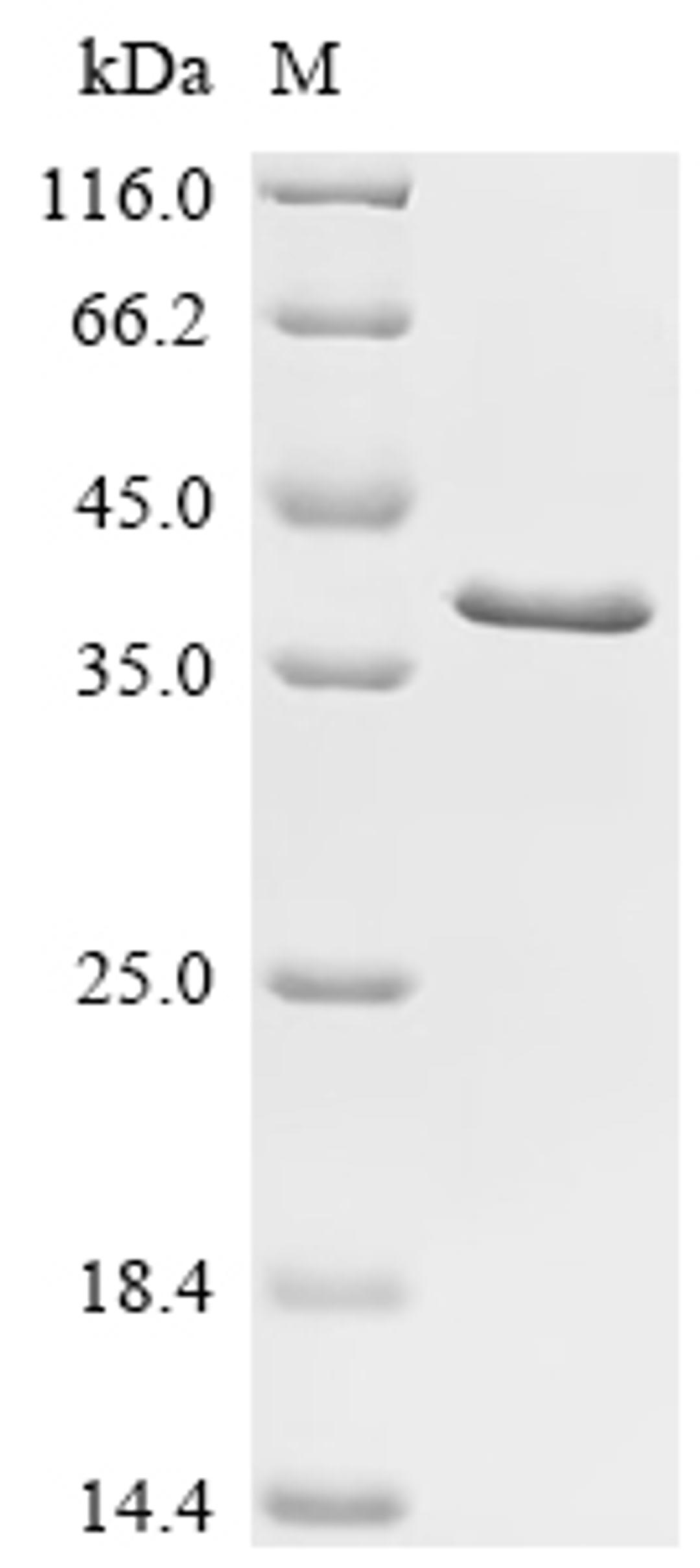 (Tris-Glycine gel) Discontinuous SDS-PAGE (reduced) with 5% enrichment gel and 15% separation gel.