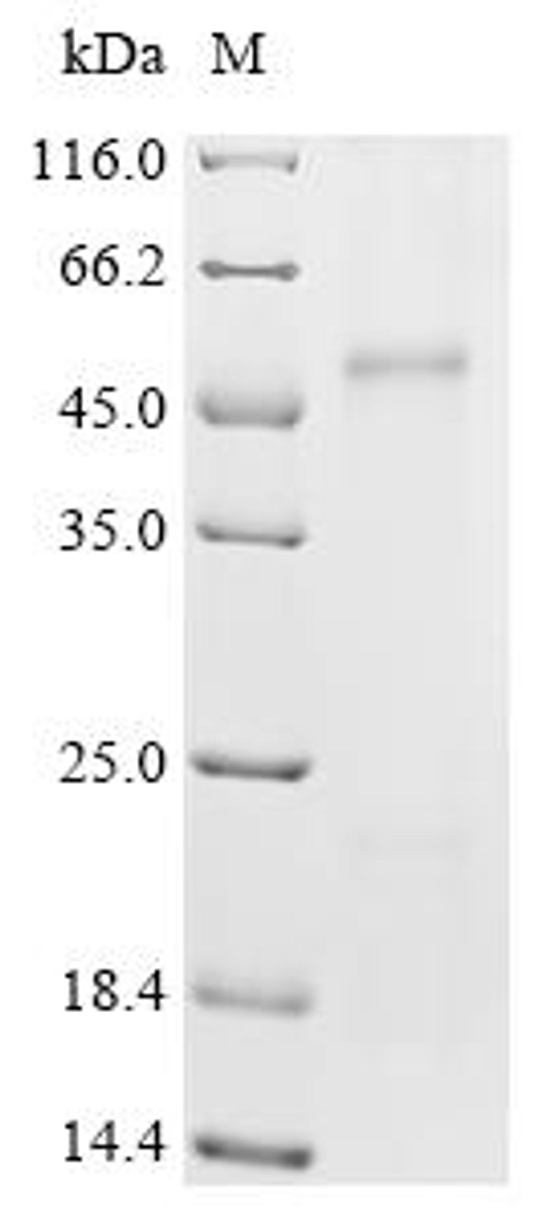 (Tris-Glycine gel) Discontinuous SDS-PAGE (reduced) with 5% enrichment gel and 15% separation gel.