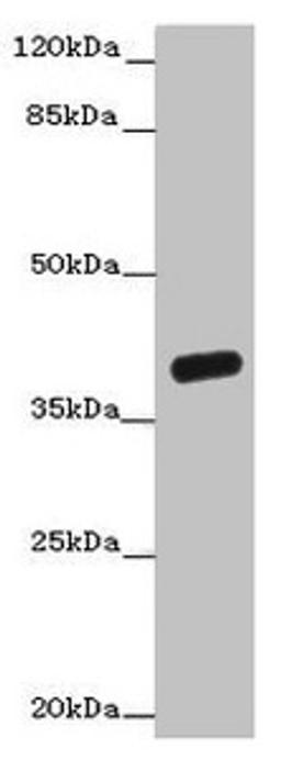 Western blot. All lanes: OGFOD2 antibody at 3µg/ml + Mouse liver tissue. Secondary. Goat polyclonal to rabbit IgG at 1/10000 dilution. Predicted band size: 39, 33, 15, 21 kDa. Observed band size: 39 kDa