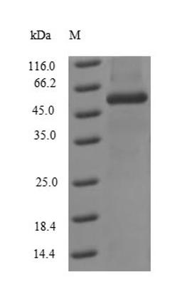 (Tris-Glycine gel) Discontinuous SDS-PAGE (reduced) with 5% enrichment gel and 15% separation gel.
