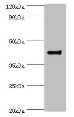 Western blot. All lanes: RGS20 antibody at 8ug/ml + Mouse brain tissue. Secondary. Goat polyclonal to rabbit IgG at 1/10000 dilution. Predicted band size: 44, 32, 22, 18, 26, 28 kDa. Observed band size: 44 kDa. 