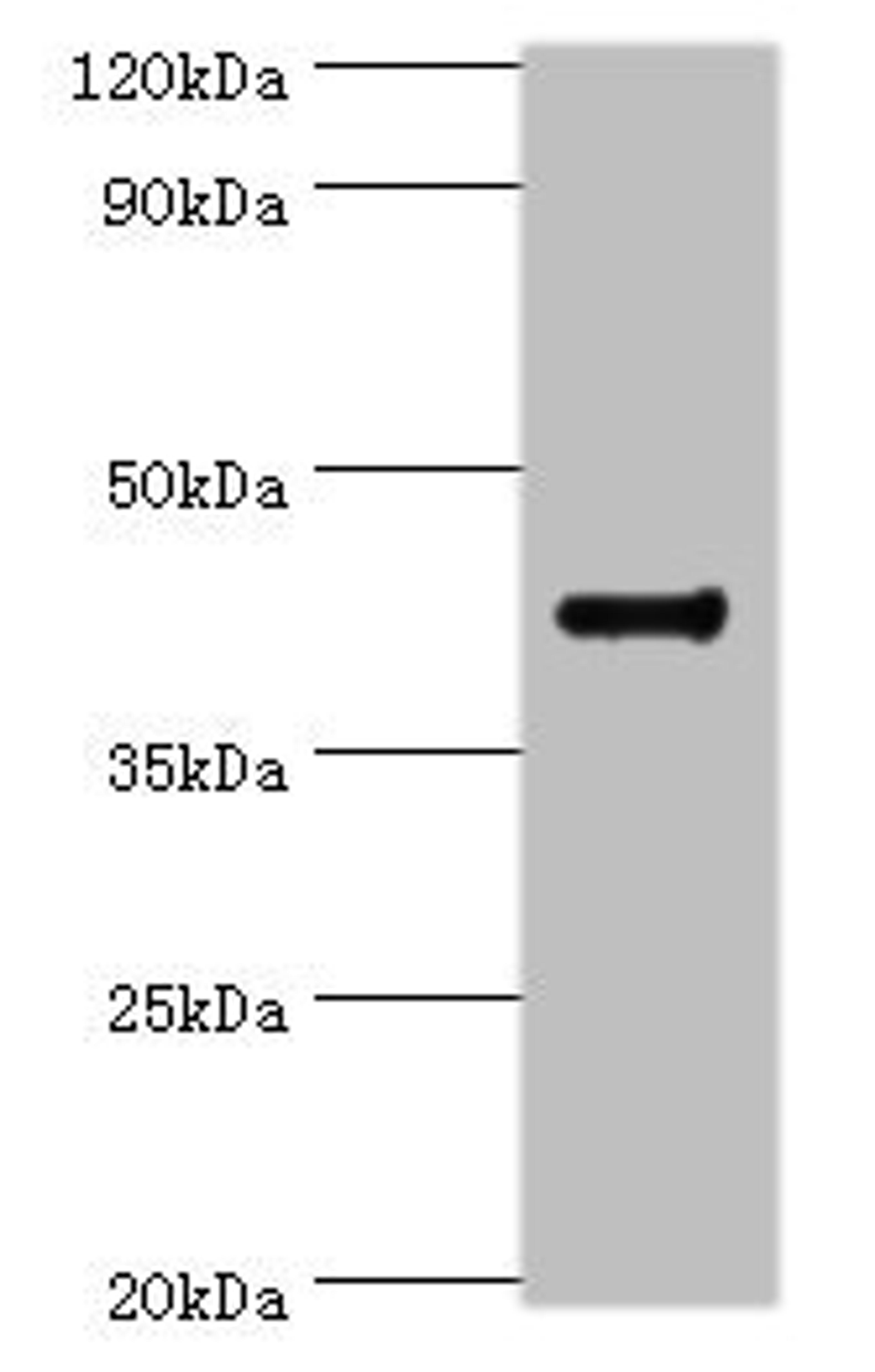 Western blot. All lanes: RGS20 antibody at 8ug/ml + Mouse brain tissue. Secondary. Goat polyclonal to rabbit IgG at 1/10000 dilution. Predicted band size: 44, 32, 22, 18, 26, 28 kDa. Observed band size: 44 kDa.