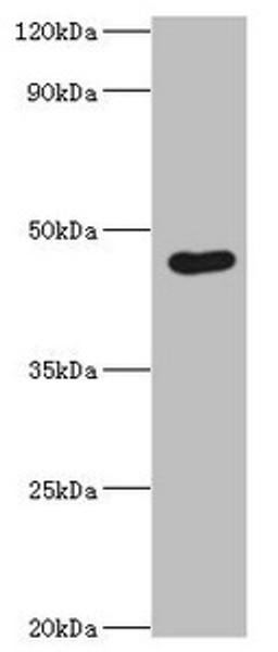 Western blot. All lanes: Egl nine homolog 1 antibody at 12ug/ml + Rat brain tissue. Secondary. Goat polyclonal to rabbit IgG at 1/10000 dilution. Predicted band size: 47, 44, 37 kDa. Observed band size: 47 kDa. 