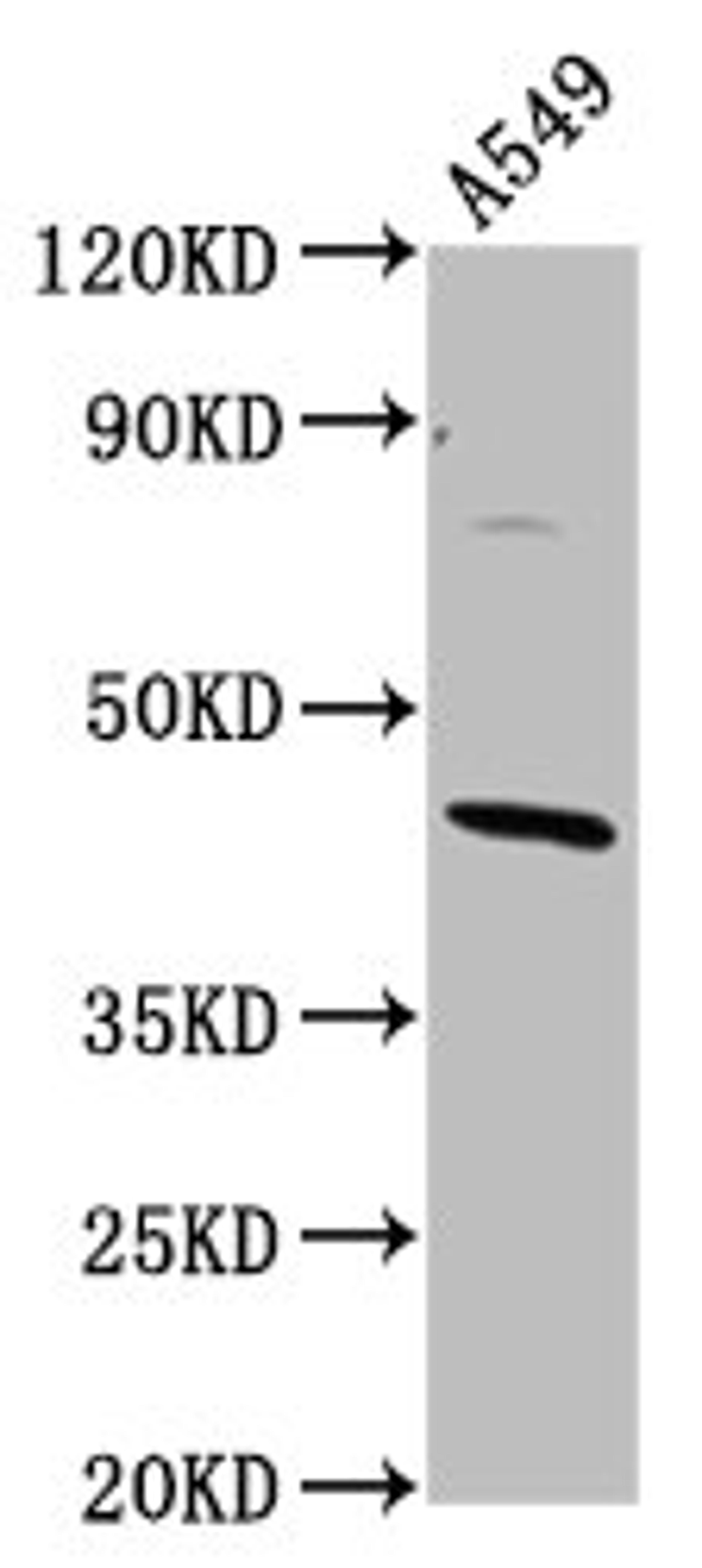 Western Blot. Positive WB detected in: A549 whole cell lysate. All lanes: ELMOD3 antibody at 4.3µg/ml. Secondary. Goat polyclonal to rabbit IgG at 1/50000 dilution. Predicted band size: 44, 29, 19, 21, 45 kDa. Observed band size: 44 kDa