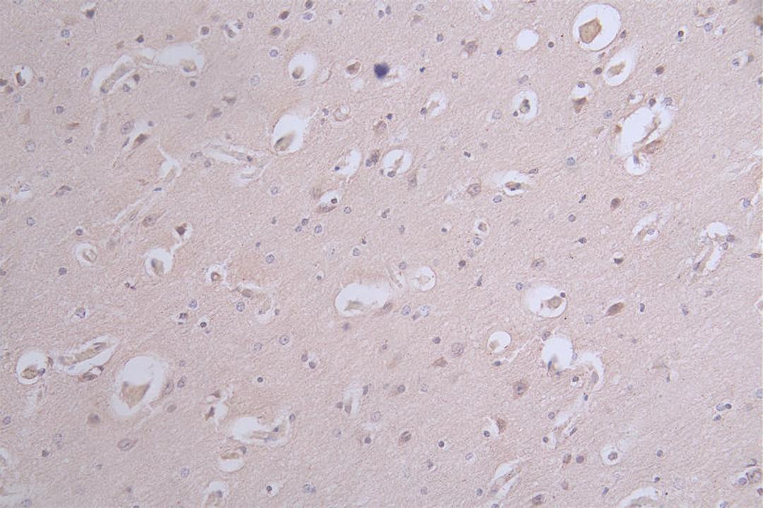 IHC image of CSB-RA050476A0HU diluted at 1:100 and staining in paraffin-embedded human brain tissue performed on a Leica BondTM system. After dewaxing and hydration, antigen retrieval was mediated by high pressure in a citrate buffer (pH 6.0). Section was blocked with 10% normal goat serum 30min at RT. Then primary antibody (1% BSA) was incubated at 4°C overnight. The primary is detected by a Goat anti-rabbit polymer IgG labeled by HRP and visualized using 0.12% DAB.