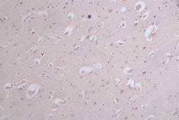 IHC image of CSB-RA050476A0HU diluted at 1:100 and staining in paraffin-embedded human brain tissue performed on a Leica BondTM system. After dewaxing and hydration, antigen retrieval was mediated by high pressure in a citrate buffer (pH 6.0). Section was blocked with 10% normal goat serum 30min at RT. Then primary antibody (1% BSA) was incubated at 4°C overnight. The primary is detected by a Goat anti-rabbit polymer IgG labeled by HRP and visualized using 0.12% DAB.