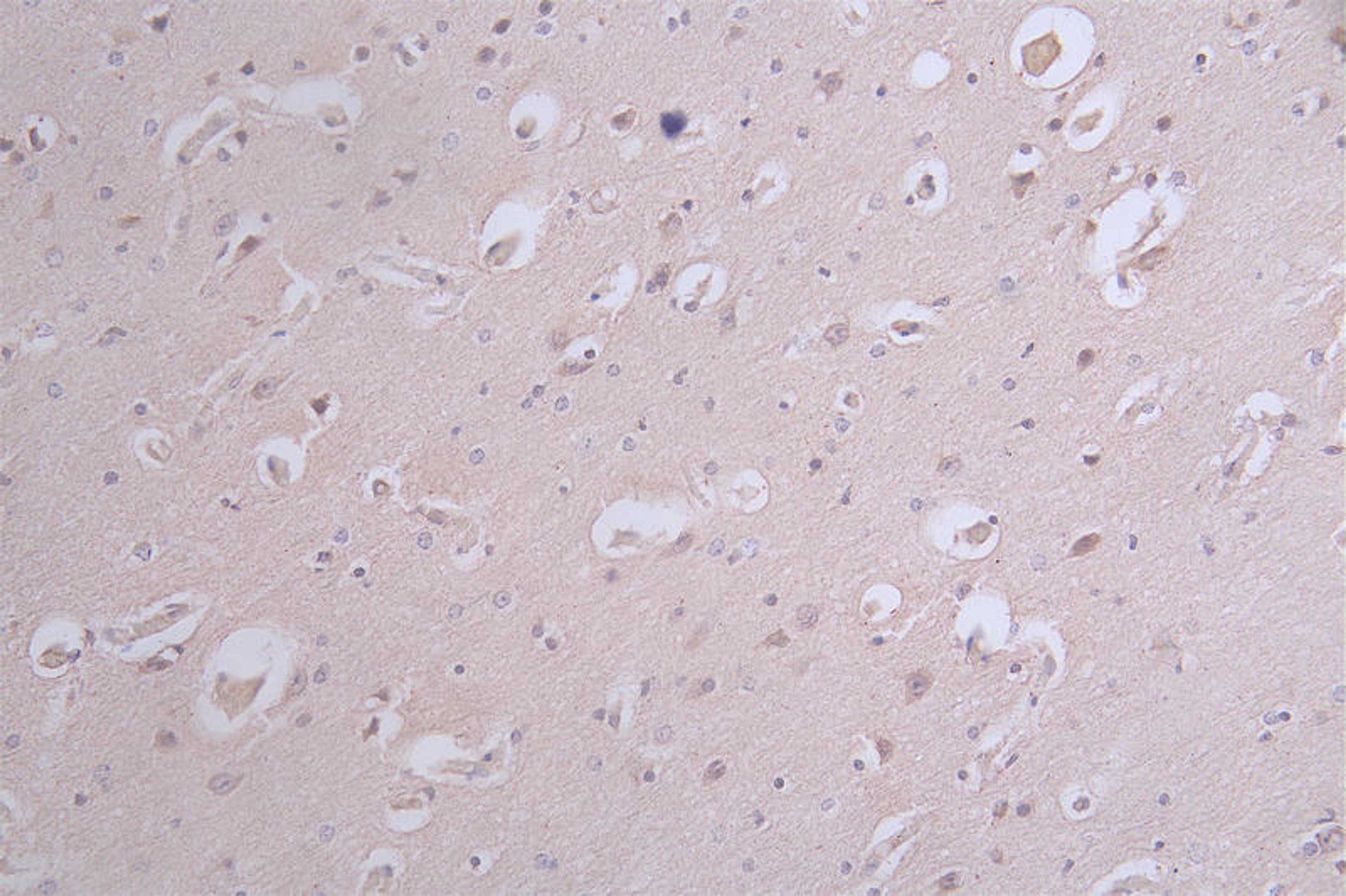 IHC image of CSB-RA050476A0HU diluted at 1:100 and staining in paraffin-embedded human brain tissue performed on a Leica BondTM system. After dewaxing and hydration, antigen retrieval was mediated by high pressure in a citrate buffer (pH 6.0). Section was blocked with 10% normal goat serum 30min at RT. Then primary antibody (1% BSA) was incubated at 4°C overnight. The primary is detected by a Goat anti-rabbit polymer IgG labeled by HRP and visualized using 0.12% DAB.