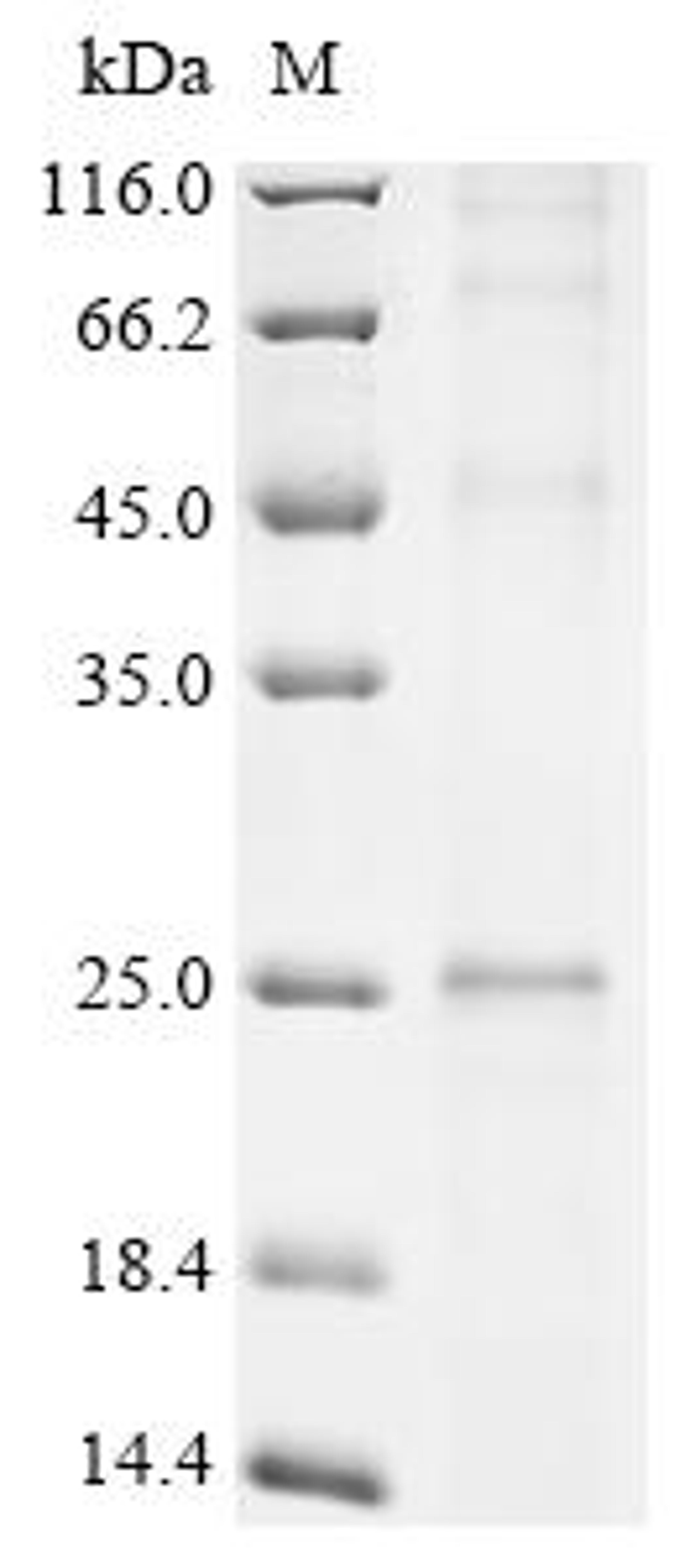 (Tris-Glycine gel) Discontinuous SDS-PAGE (reduced) with 5% enrichment gel and 15% separation gel.