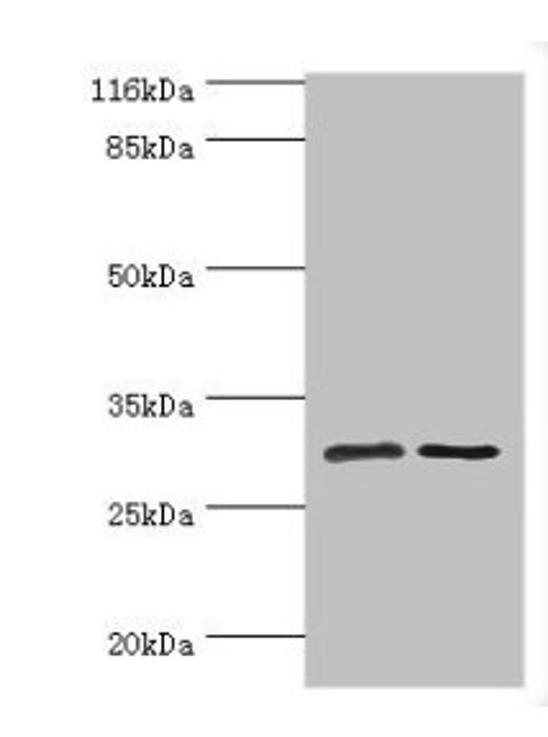 Western blot. All lanes: SRPRB antibody at 2ug/ml. Lane 1: HepG2 whole cell lysate. Lane 2: Hela whole cell lysate. Secondary. Goat polyclonal to rabbit IgG at 1/10000 dilution. Predicted band size: 30 kDa. Observed band size: 30 kDa. 