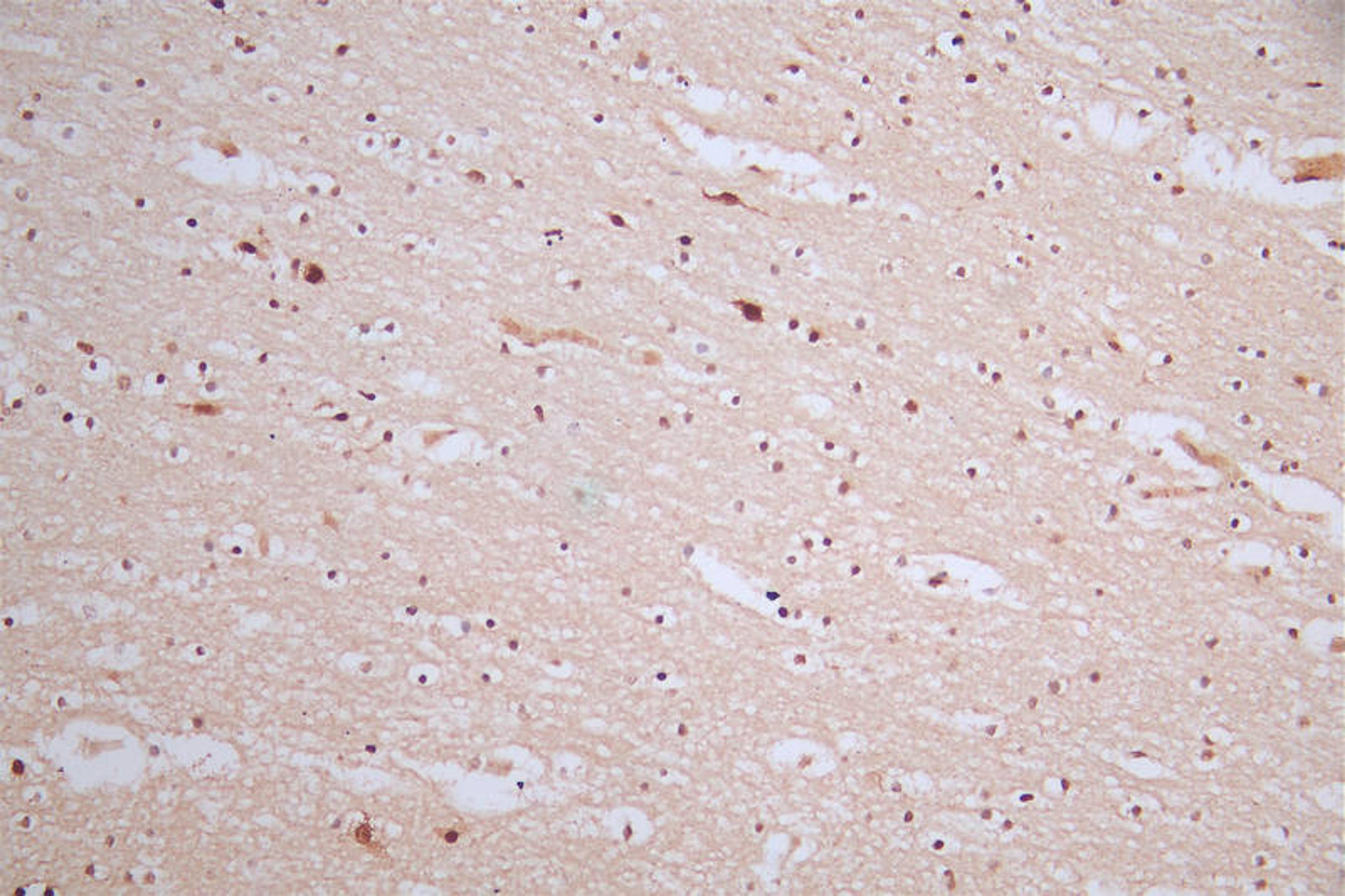 IHC image of CSB-RA980583A0HU diluted at 1:50 and staining in paraffin-embedded human brain tissue performed on a Leica BondTM system. After dewaxing and hydration, antigen retrieval was mediated by high pressure in a citrate buffer (pH 6.0). Section was blocked with 10% normal goat serum 30min at RT. Then primary antibody (1% BSA) was incubated at 4°C overnight. The primary is detected by a Goat anti-rabbit polymer IgG labeled by HRP and visualized using 0.57% DAB.