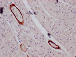 IHC image of CSB-MA166134 diluted at 1:100 and staining in paraffin-embedded human heart tissue performed on a Leica BondTM system. After dewaxing and hydration, antigen retrieval was mediated by high pressure in a citrate buffer (pH 6.0). Section was blocked with 10% normal goat serum 30min at RT. Then primary antibody (1% BSA) was incubated at 4°C overnight. The primary is detected by a Goat anti-mouse IgG polymer labeled by HRP and visualized using 0.05% DAB.