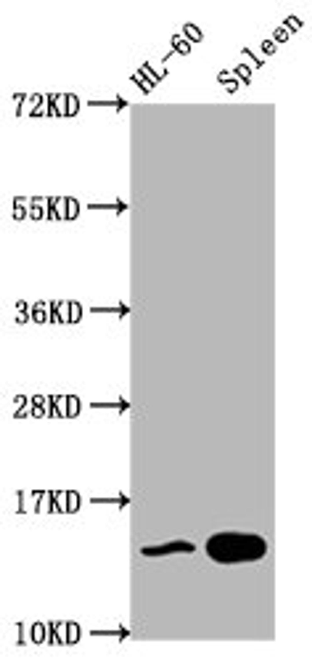 Western Blot. Positive WB detected in: HL60 whole cell lysate, Rat spleen tissue. All lanes: HIST1H2BC antibody at 0.45µg/ml. Secondary. Goat polyclonal to rabbit IgG at 1/50000 dilution. Predicted band size: 14 kDa. Observed band size: 14 kDa