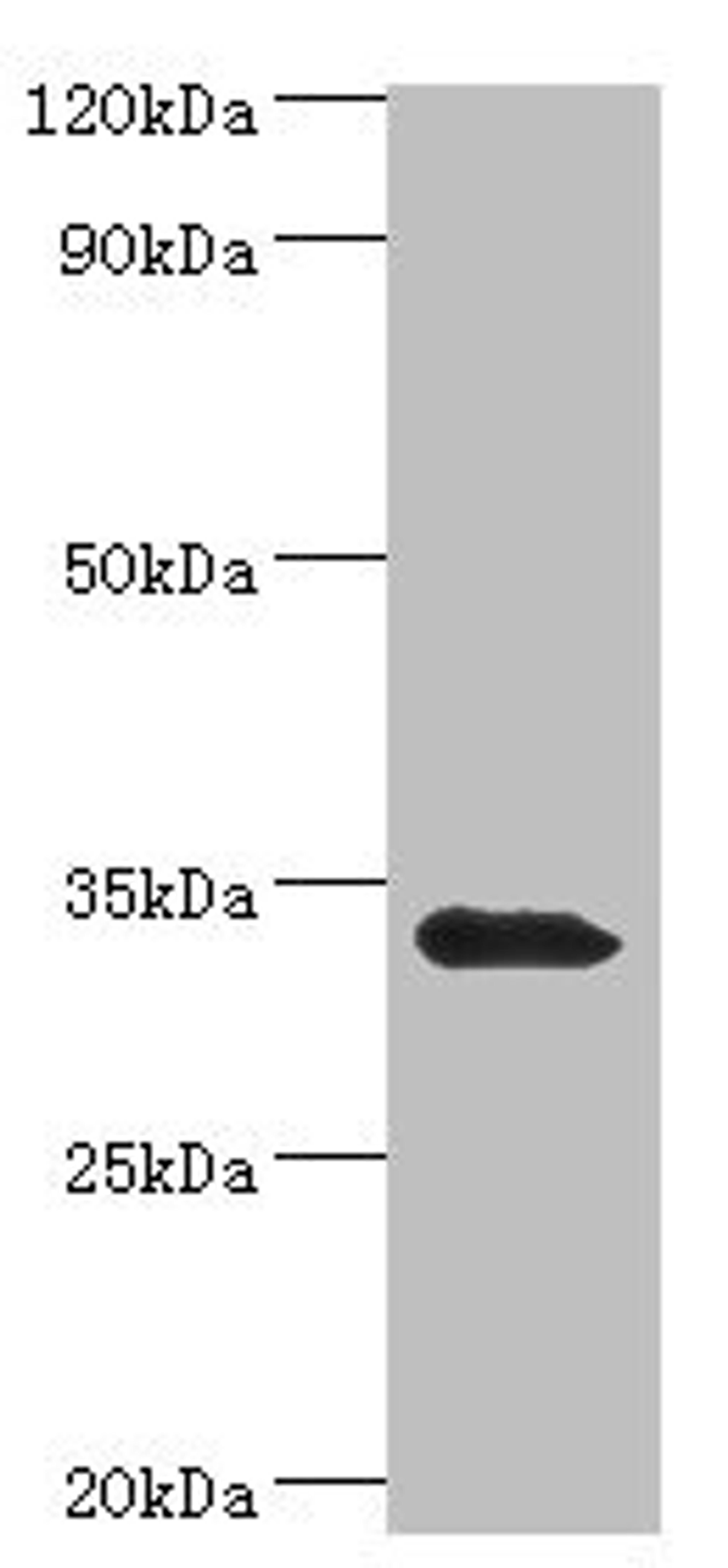 Western blot. All lanes: Mitochondrial brown fat uncoupling protein 1 antibody at 2ug/ml + Mouse kidney tissue. Secondary. Goat polyclonal to rabbit IgG at 1/10000 dilution. Predicted band size: 33 kDa. Observed band size: 33 kDa.