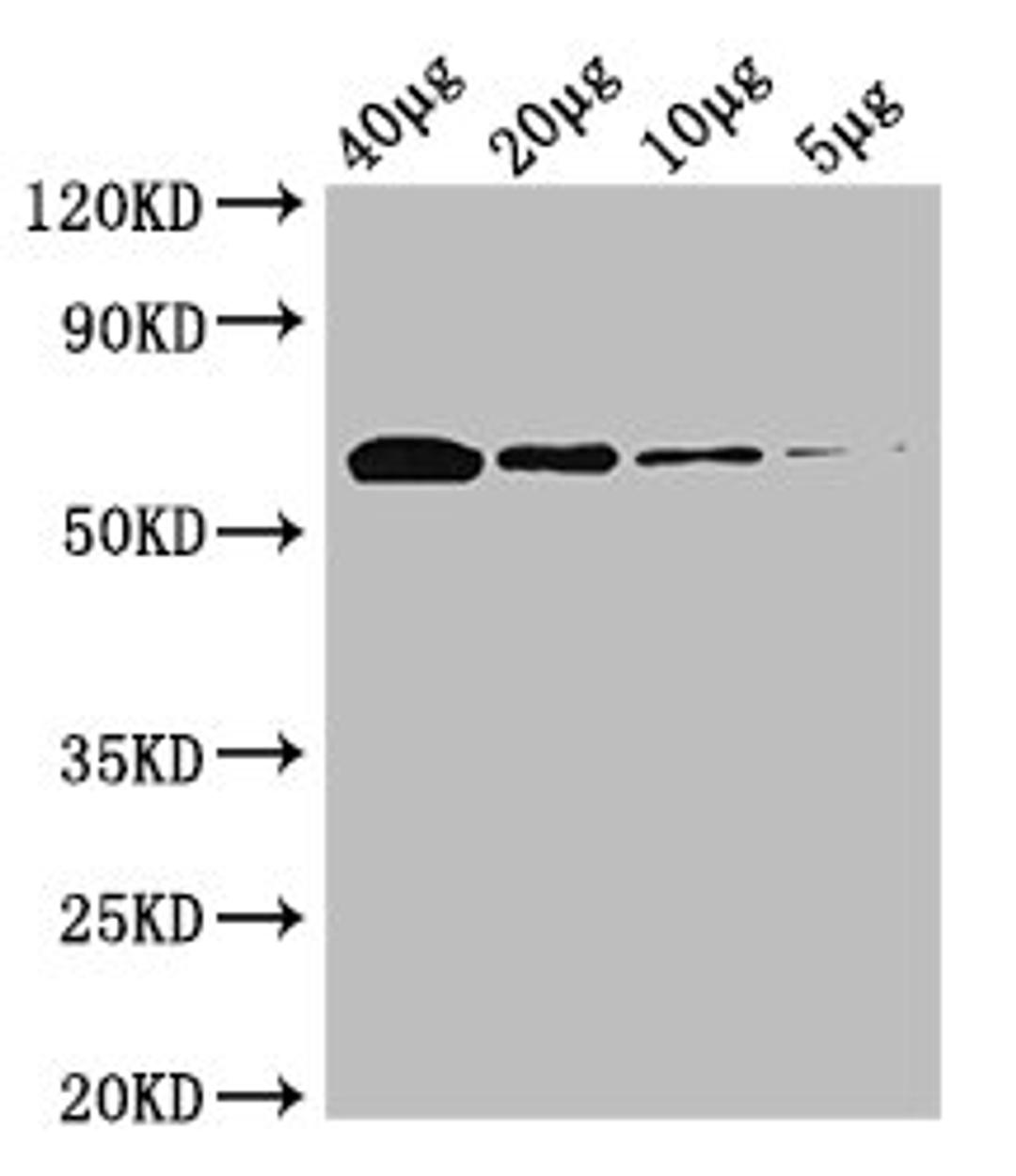Western Blot. Positive WB detected in: Rosseta bacteria lysate at 40µg, 20µg, 10µg, 5µg. All lanes: poxB antibody at 0.25µg/ml. Secondary. Goat polyclonal to rabbit IgG at 1/50000 dilution. Predicted band size: 63 kDa. Observed band size: 63 kDa