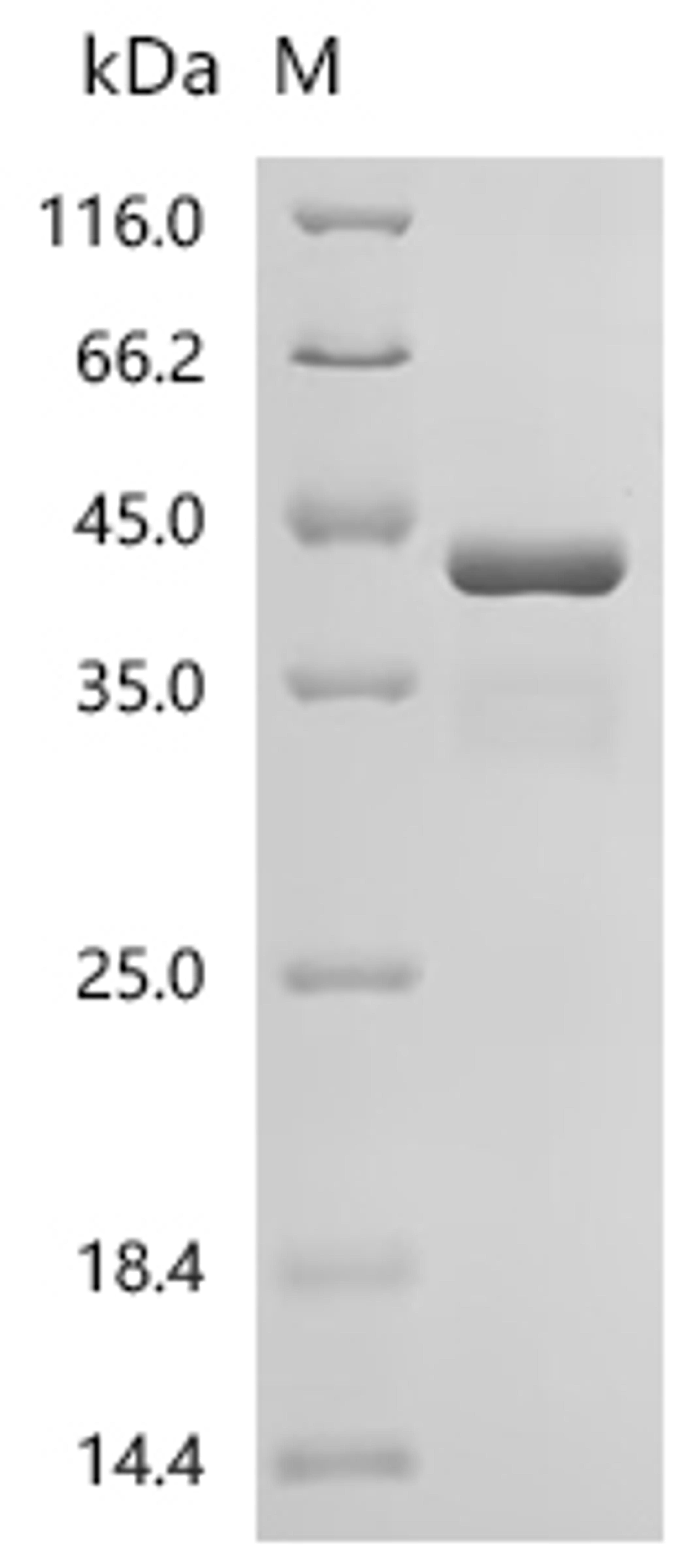 (Tris-Glycine gel) Discontinuous SDS-PAGE (reduced) with 5% enrichment gel and 15% separation gel.