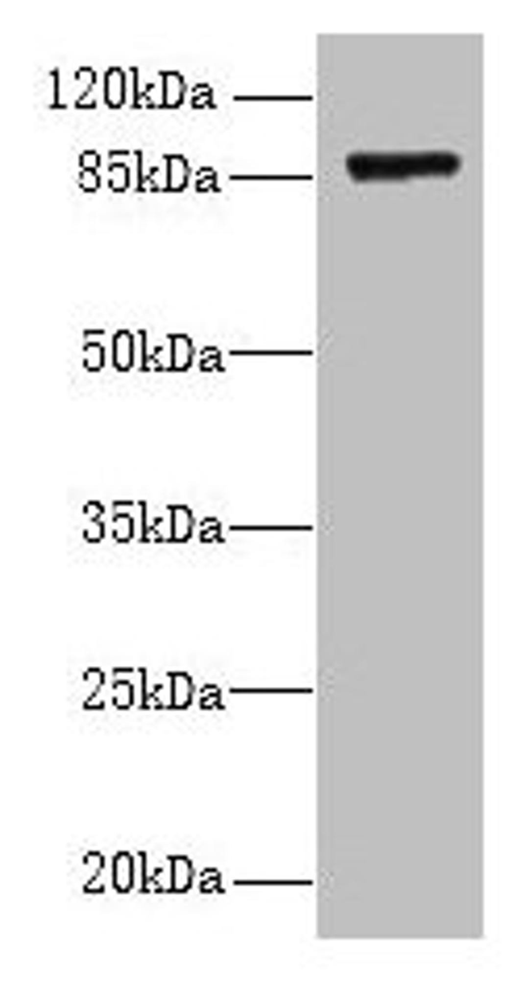 Western blot. All lanes: FSCB antibody at 1.5µg/ml + Mouse liver tissue. Secondary. Goat polyclonal to rabbit IgG at 1/10000 dilution. Predicted band size: 88 kDa. Observed band size: 88 kDa