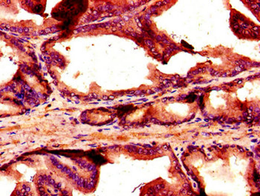 Immunohistochemistry of paraffin-embedded human prostate tissue using CSB-PA015959LA01HU at dilution of 1:100
