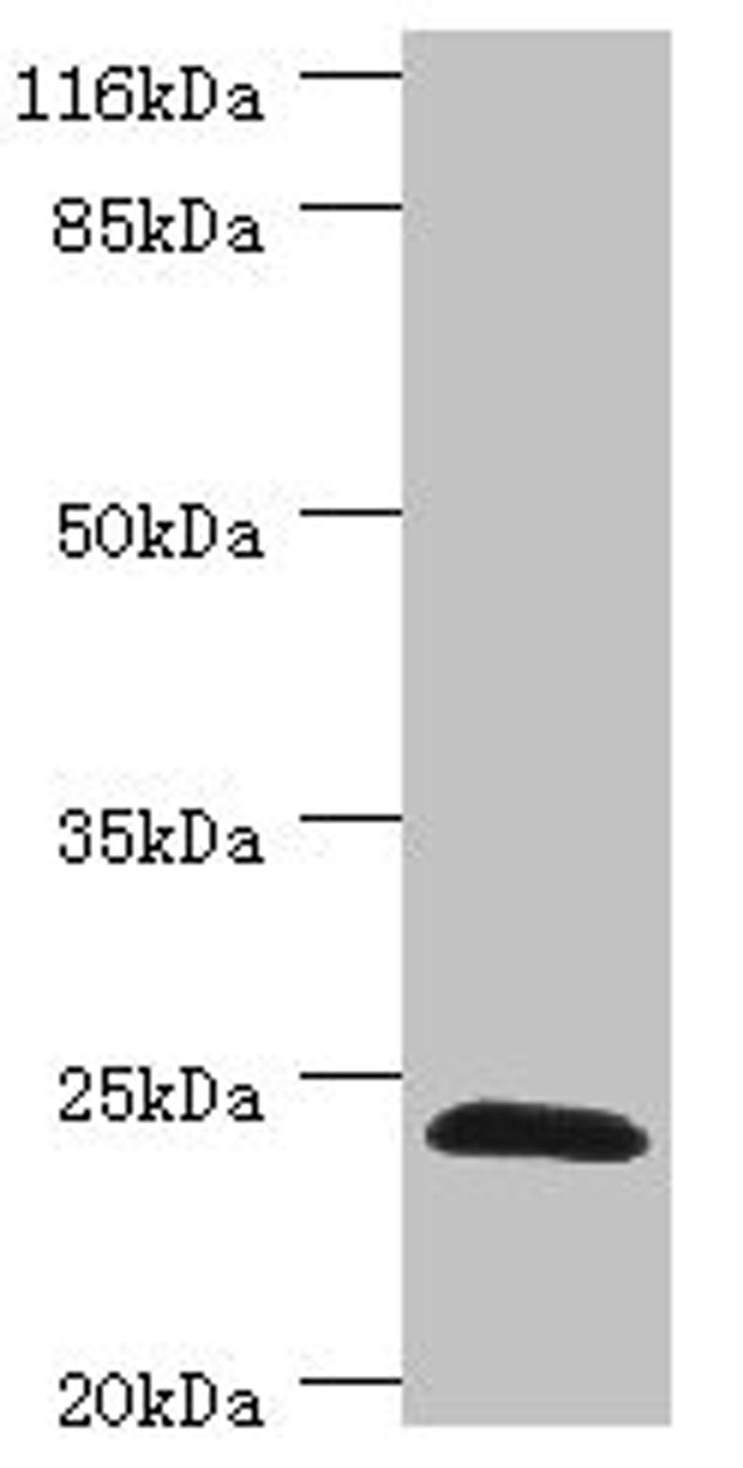 Western blot. All lanes: GSTZ1 antibody at 0.41ug/ml + Mouse liver tissue. Secondary. Goat polyclonal to rabbit IgG at 1/10000 dilution. Predicted band size: 25, 18, 20 kDa. Observed band size: 25 kDa. 