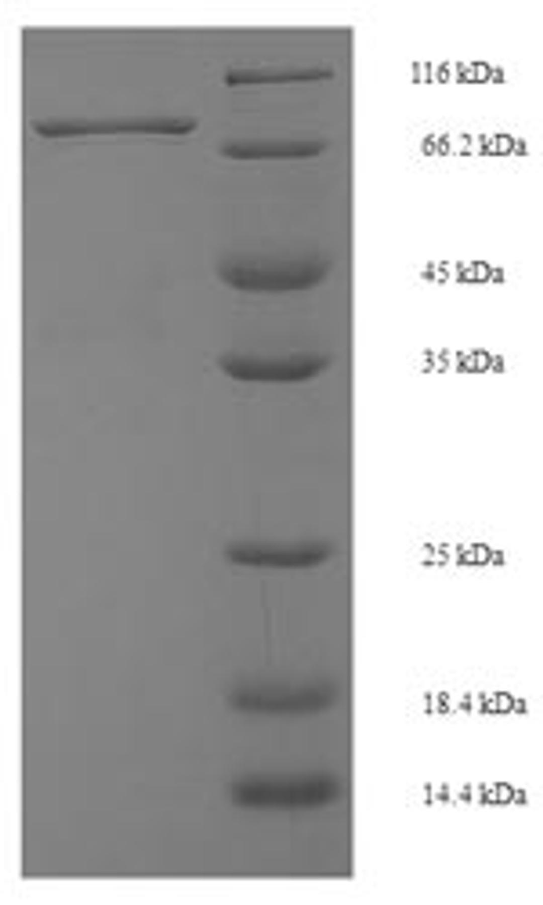 (Tris-Glycine gel) Discontinuous SDS-PAGE (reduced) with 5% enrichment gel and 15% separation gel.
