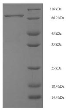(Tris-Glycine gel) Discontinuous SDS-PAGE (reduced) with 5% enrichment gel and 15% separation gel.