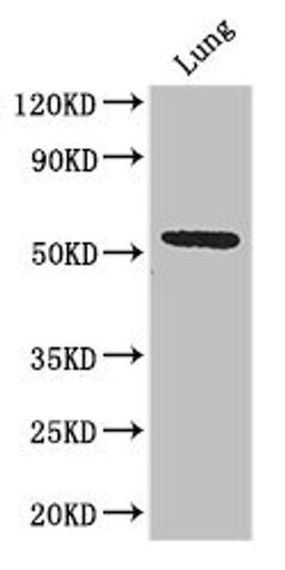 Western Blot. Positive WB detected in: Mouse lung tissue. All lanes: Q9NQ4 antibody at 3.2ug/ml. Secondary. Goat polyclonal to rabbit IgG at 1/50000 dilution. Predicted band size: 51, 46 kDa. Observed band size: 51 kDa. 