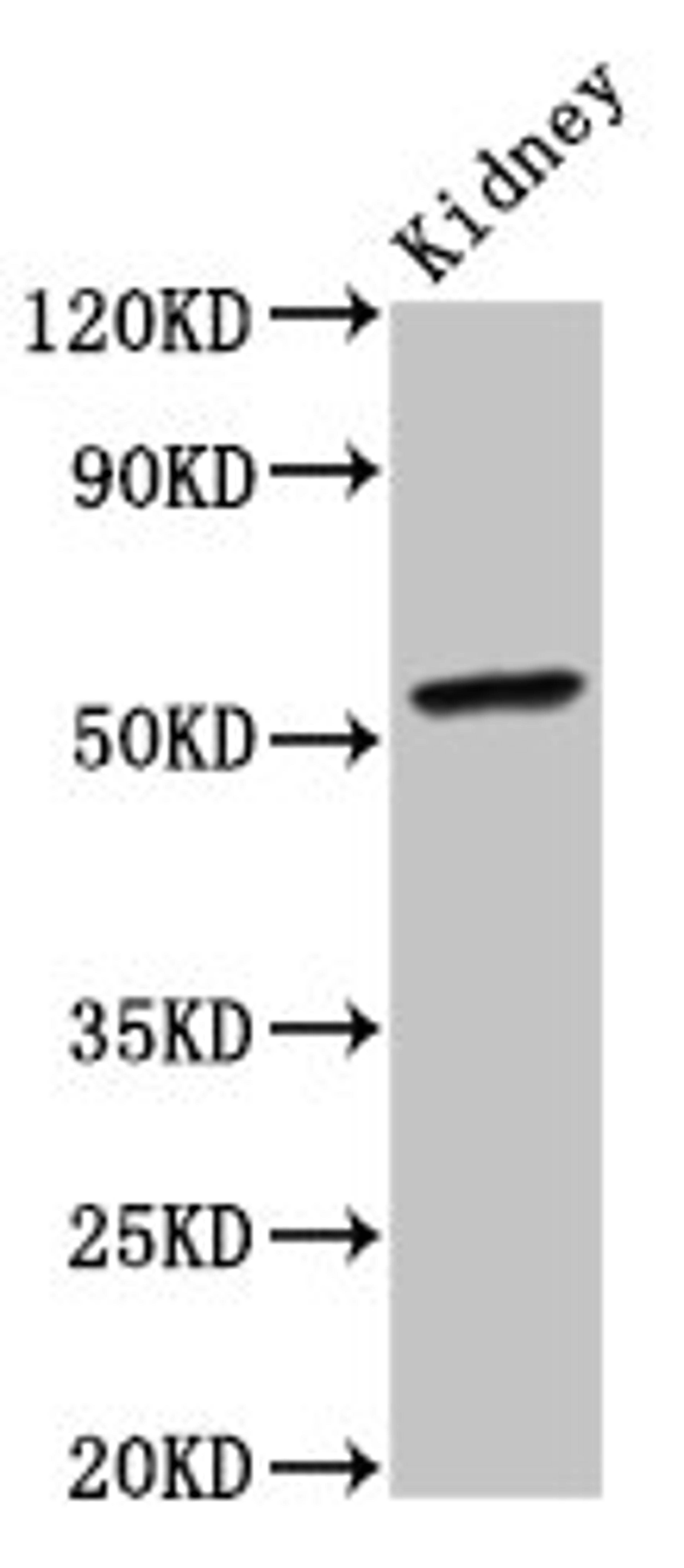 Western Blot. Positive WB detected in: Mouse kidney tissue. All lanes: CYP2C19 antibody at 4ug/ml. Secondary. Goat polyclonal to rabbit IgG at 1/50000 dilution. Predicted band size: 56 kDa. Observed band size: 56 kDa.