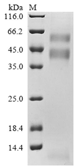 (Tris-Glycine gel) Discontinuous SDS-PAGE (reduced) with 5% enrichment gel and 15% separation gel.