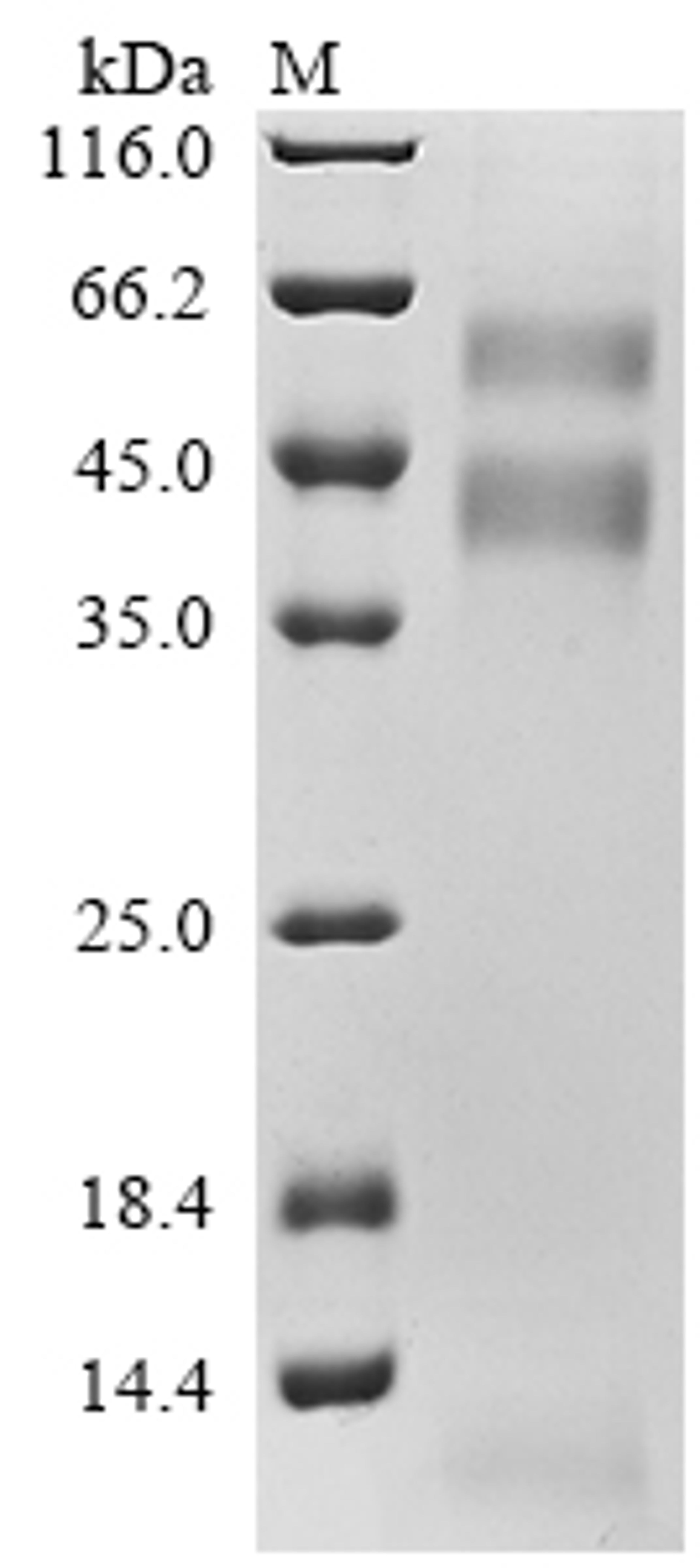 (Tris-Glycine gel) Discontinuous SDS-PAGE (reduced) with 5% enrichment gel and 15% separation gel.