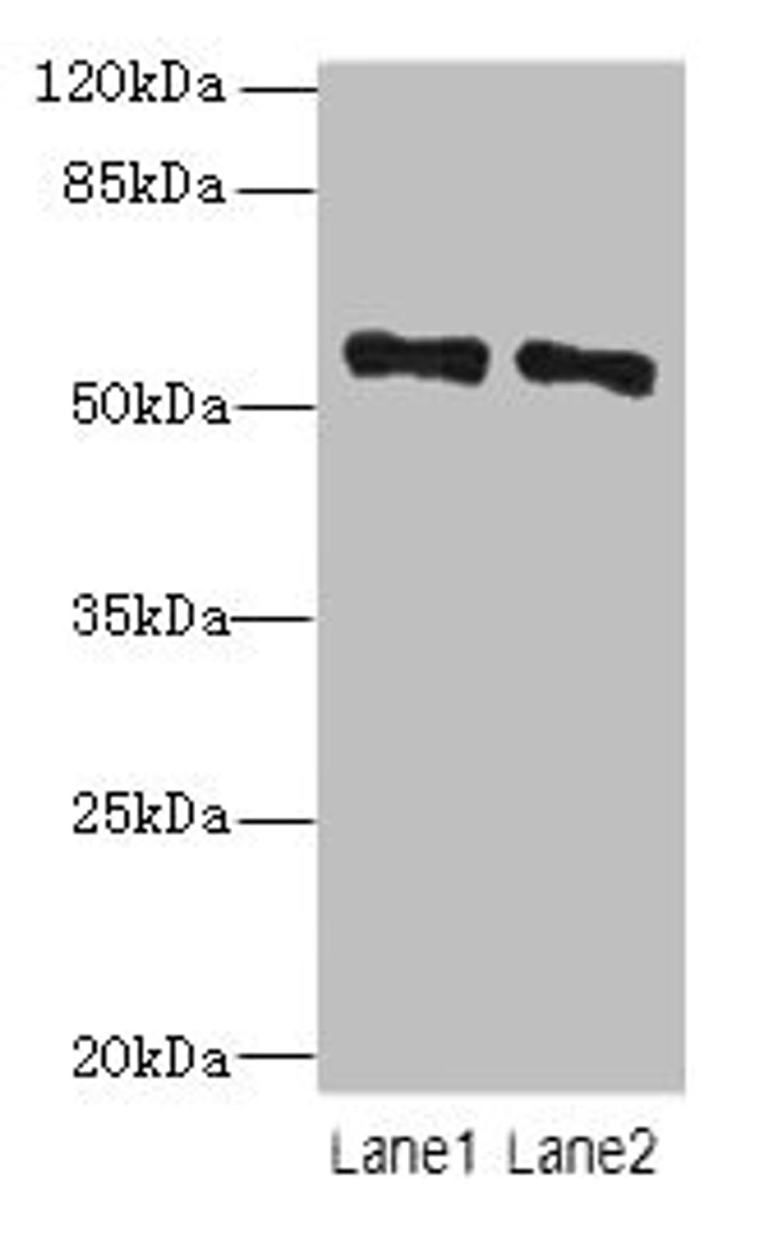 Western blot. All lanes: ZNF689 antibody at 5µg/ml. Lane 1: Hela whole cell lysate. Lane 2: HepG2 whole cell lysate. Secondary. Goat polyclonal to rabbit IgG at 1/10000 dilution. Predicted band size: 57 kDa. Observed band size: 57 kDa
